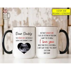 Promoted to Dad Mug, Father's Day Mug, Custom Ultrasound Gift Mug, Baby Announcement Gift for Soon to Be Dad, New Baby R
