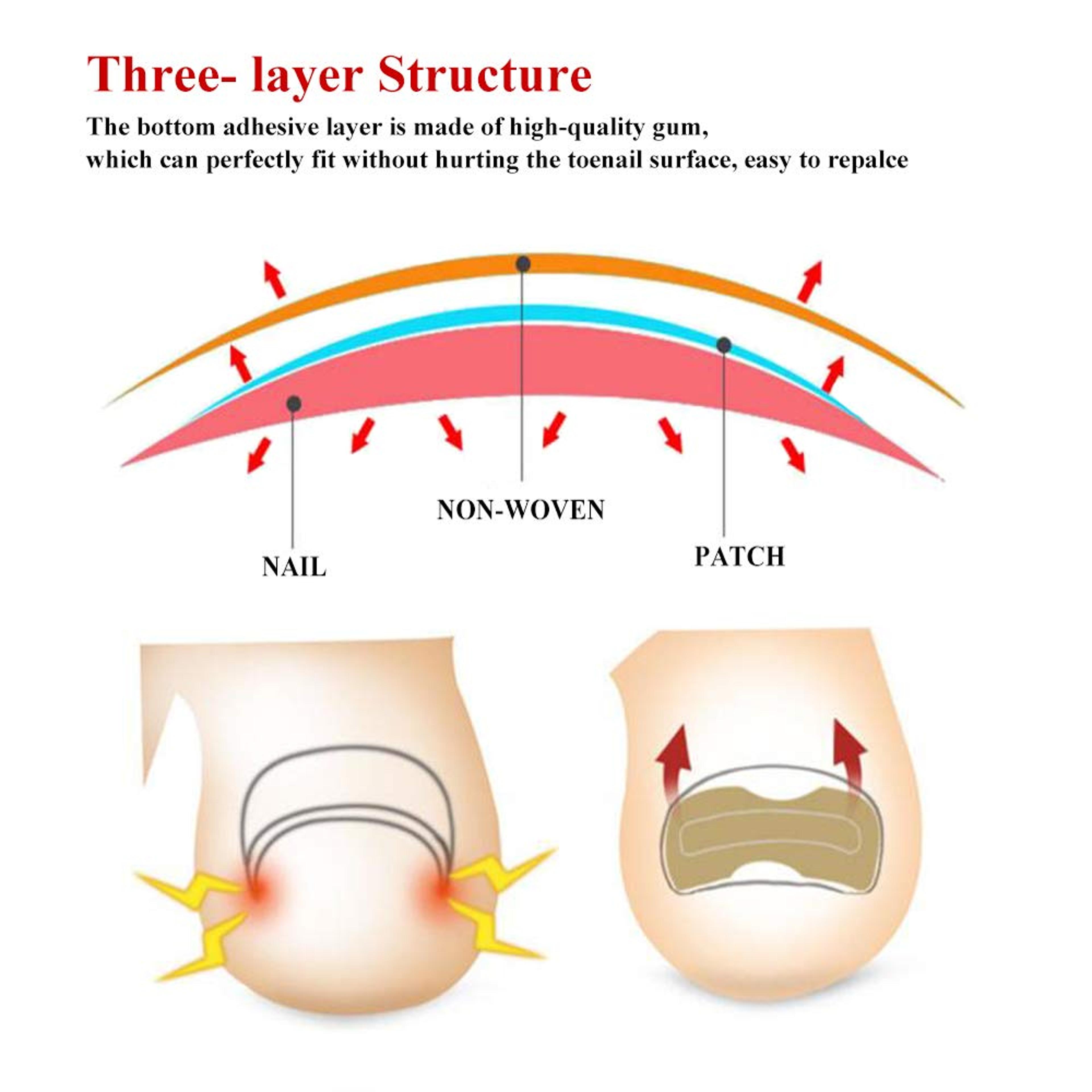Highquality nail correction patches for home use