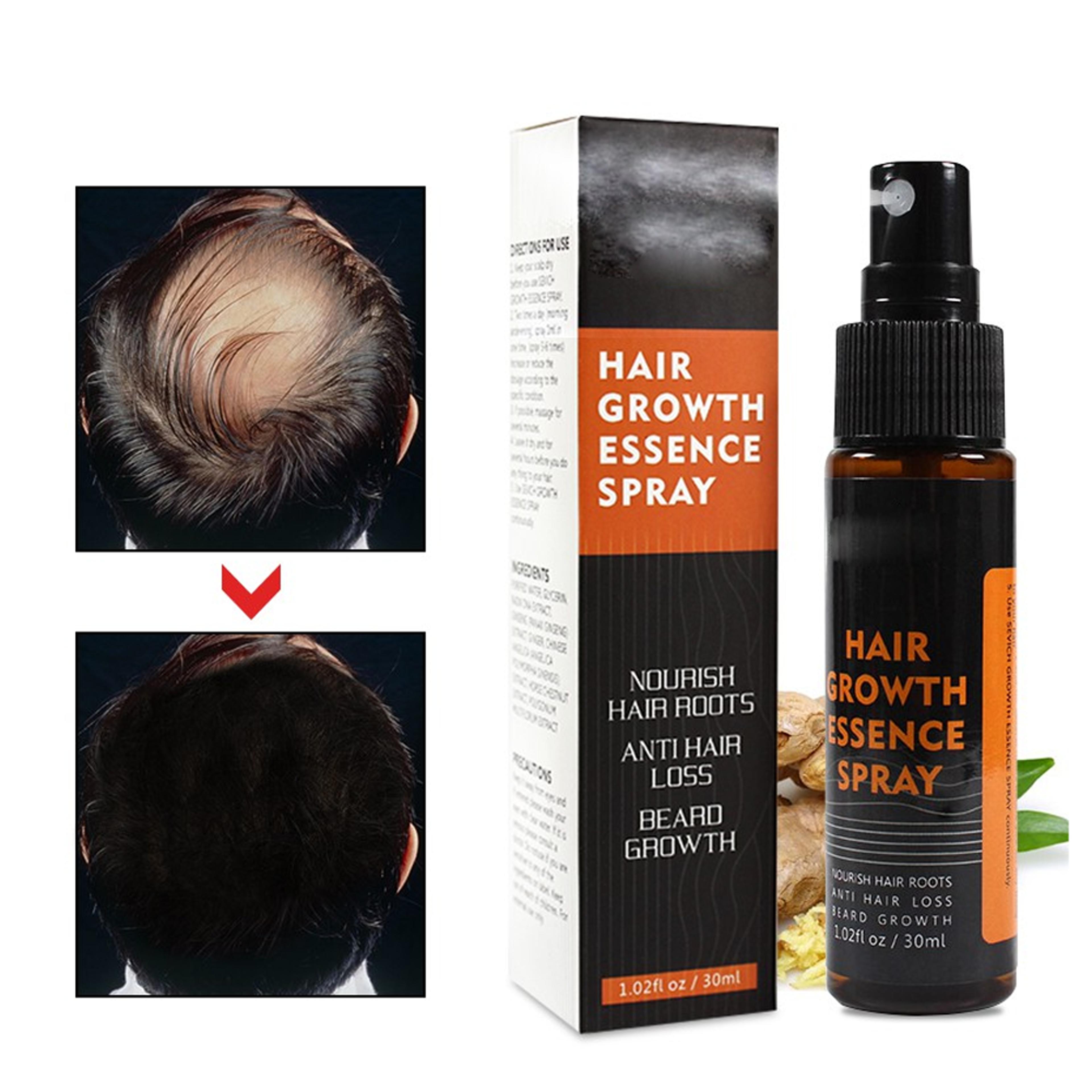 hairregrowthherbalessencespray4 (1).png