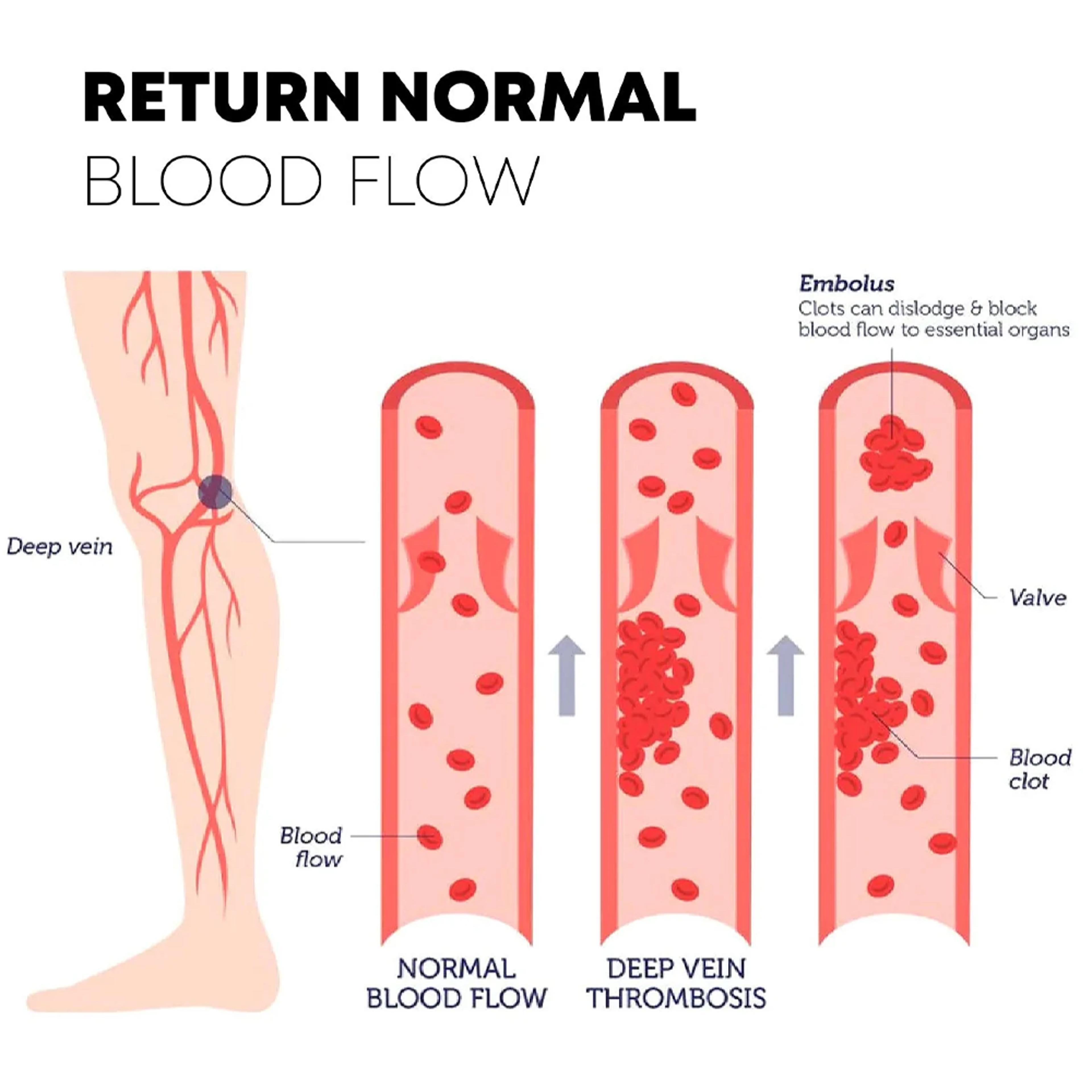 veinhealingthermovaricosesocks5.png