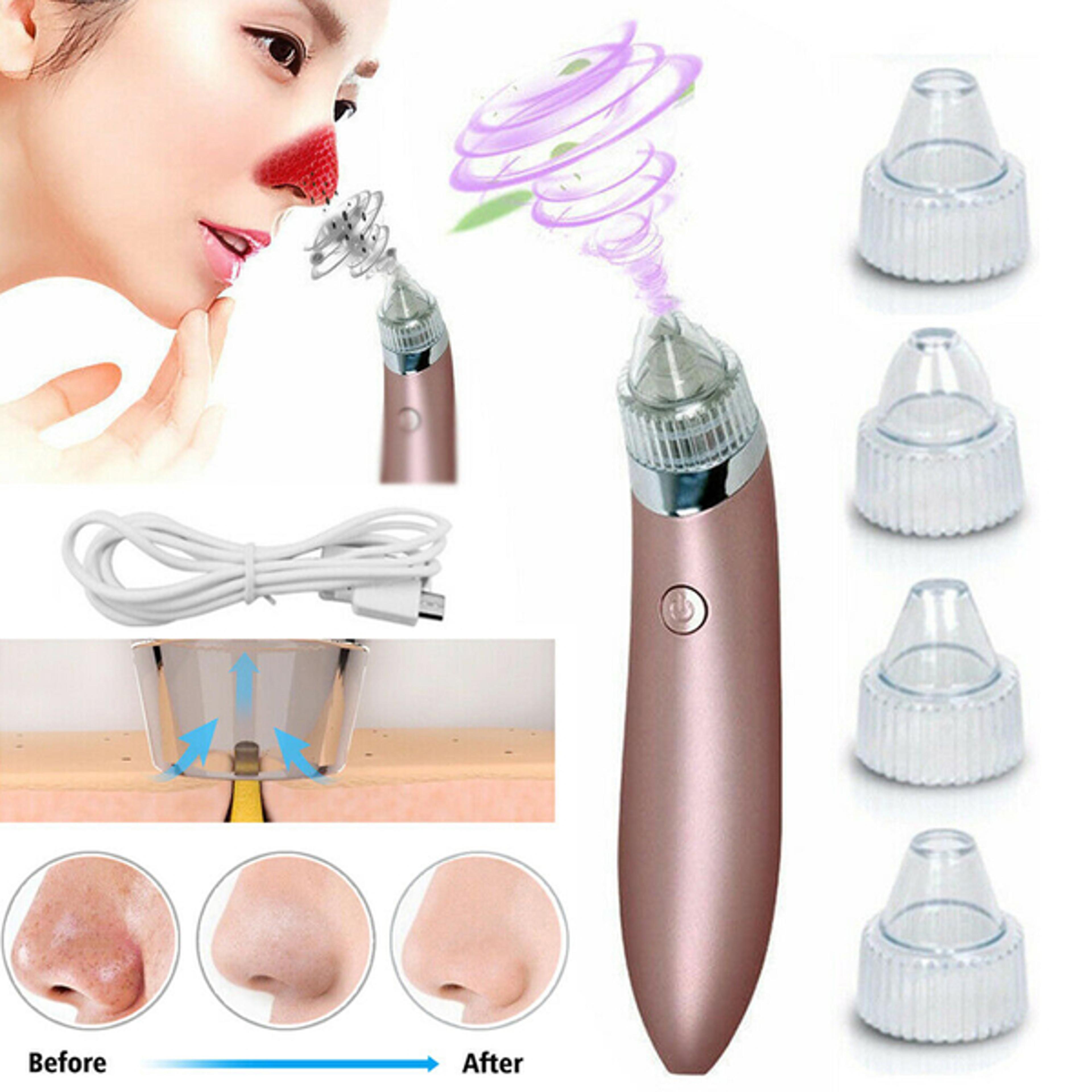 electric blackhead remover pore vacuum cleanser