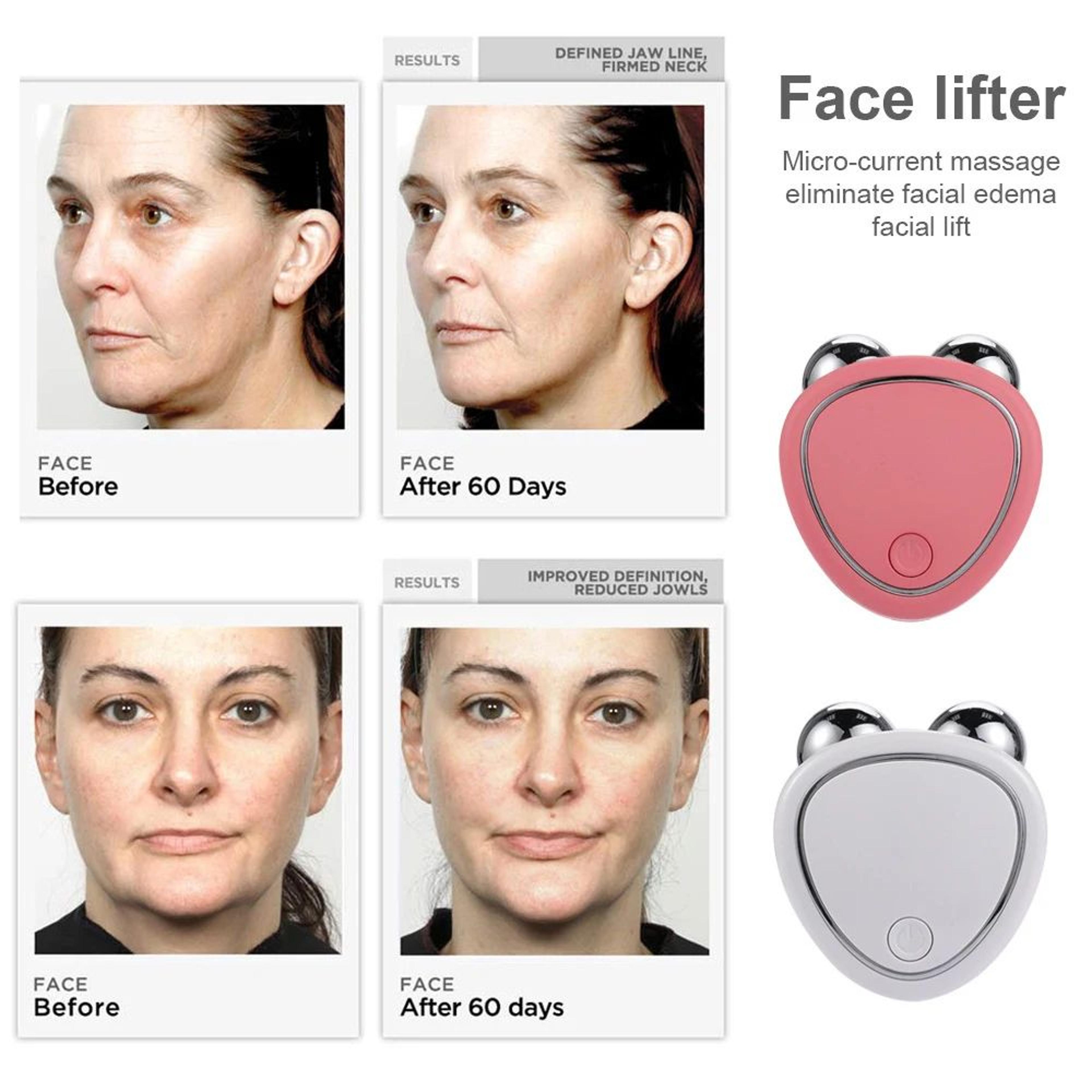 Facial Massager Microcurrent Face Lifting Machine Skin Tightening Roller For AntiWrinkle Rejuvenati 1