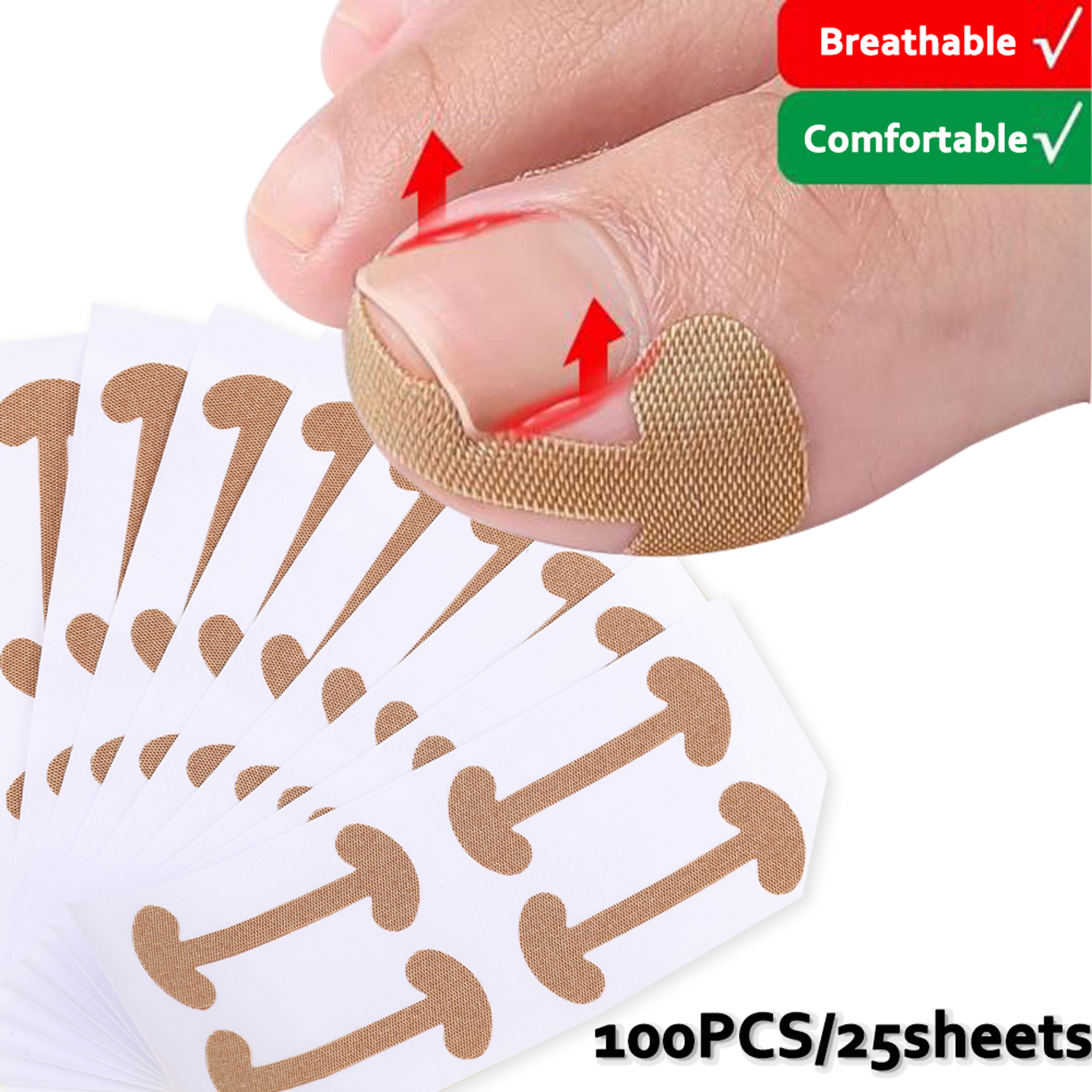 Ingrown Toenail Correction Strips Waterproof Nail Care Stickers For Comfortable Toe Support 1