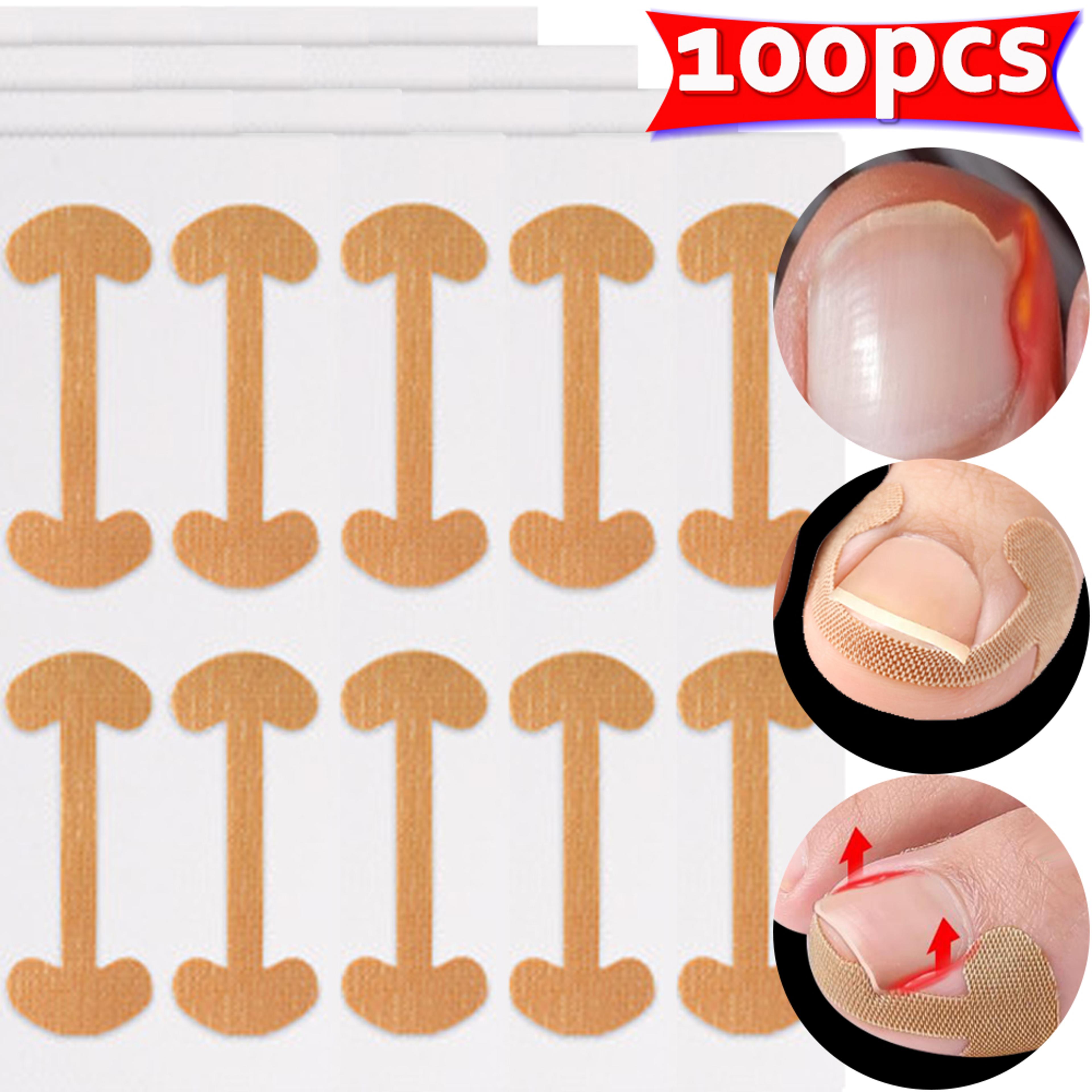 Ingrown Toenail Correction Strips Waterproof Nail Care Stickers For Comfortable Toe Support 5