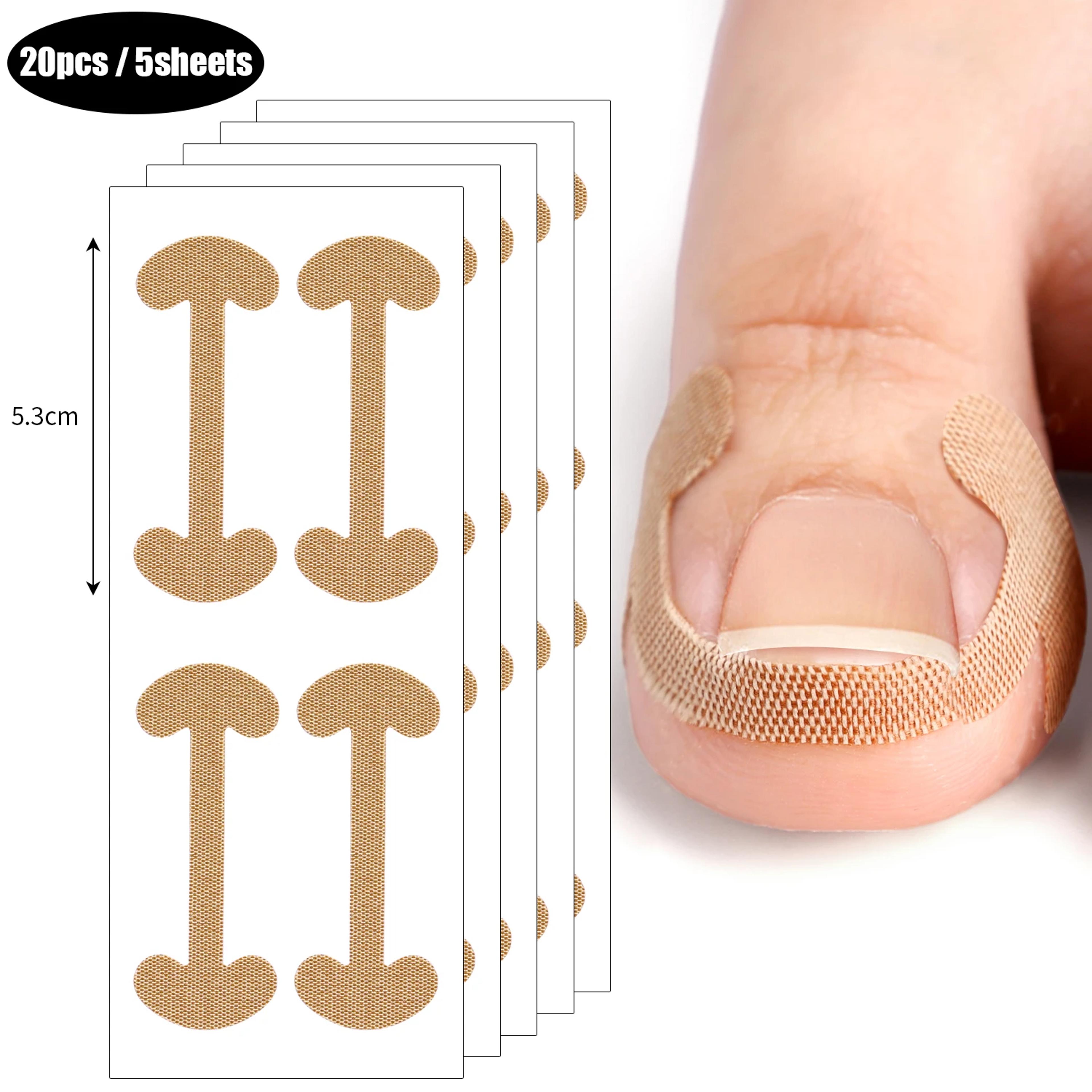 Ingrown Toenail Correction Strips Waterproof Nail Care Stickers For Comfortable Toe Support 6