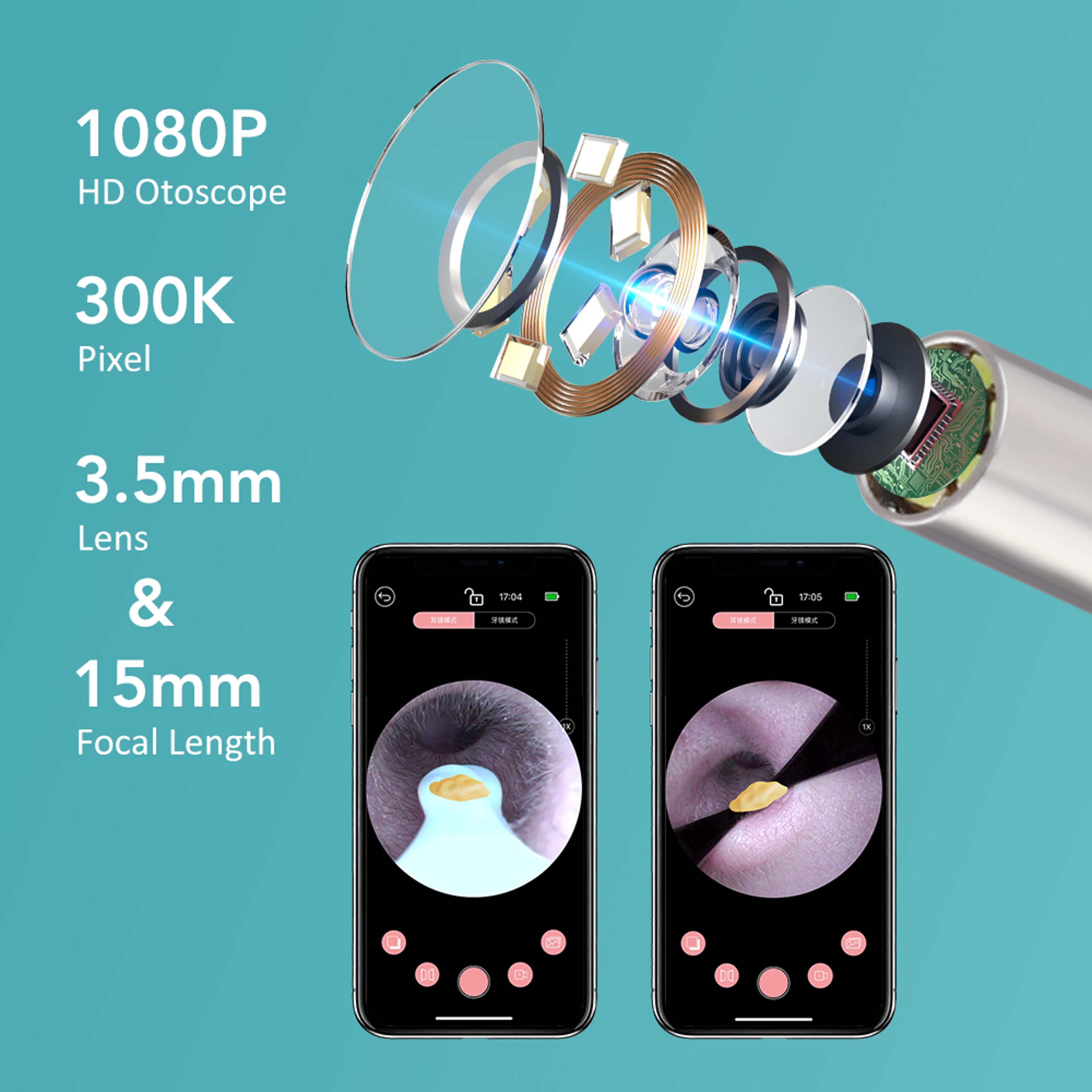 Ultra Thin 35MM Visual Wireless Otoscope HD Ear Scope With Ear Wax Cleaning Tools 2