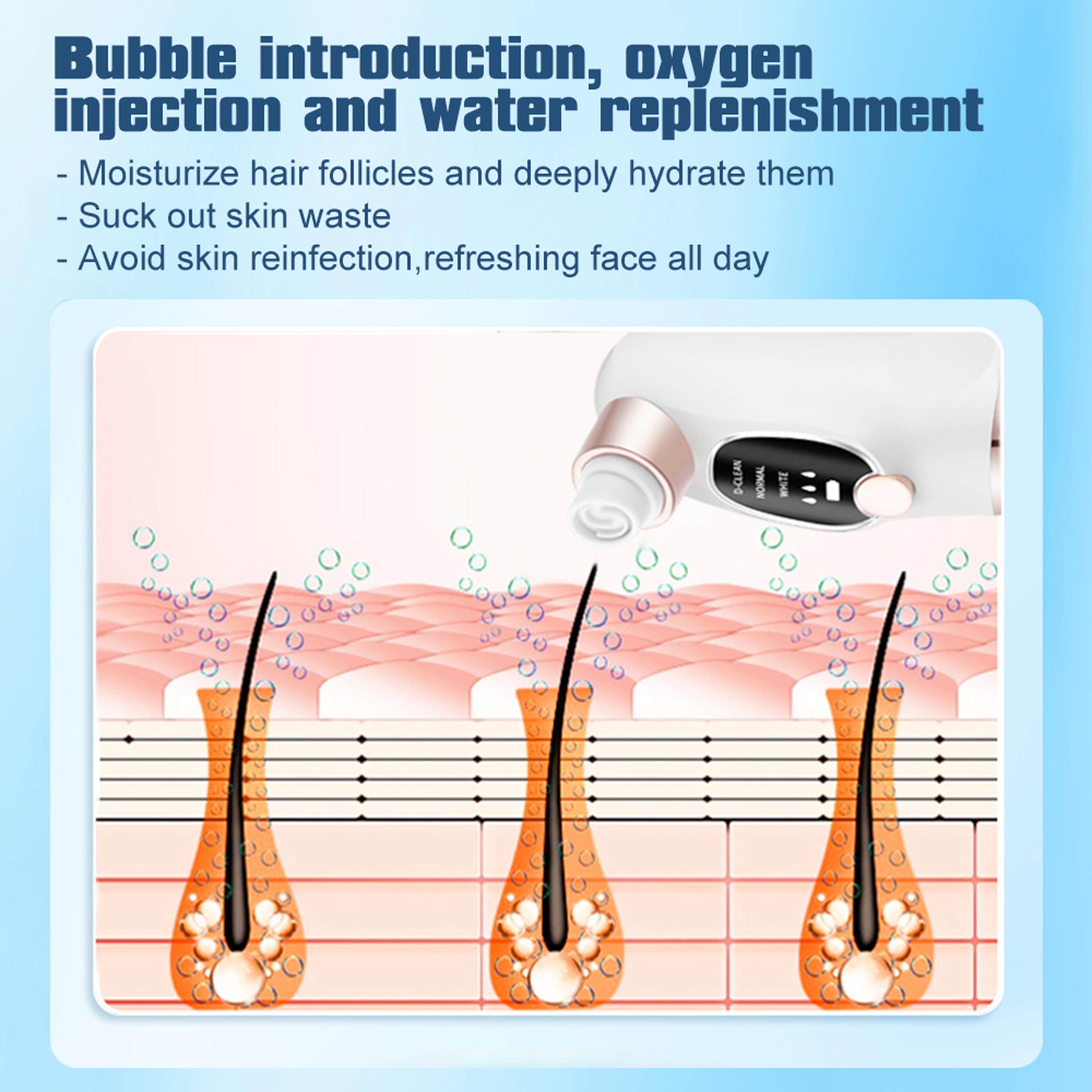 Electric Pimple Acne Blackhead Remover USB Rechargeable Face Cleaner Pore Vacuum Black Dot Removal 5
