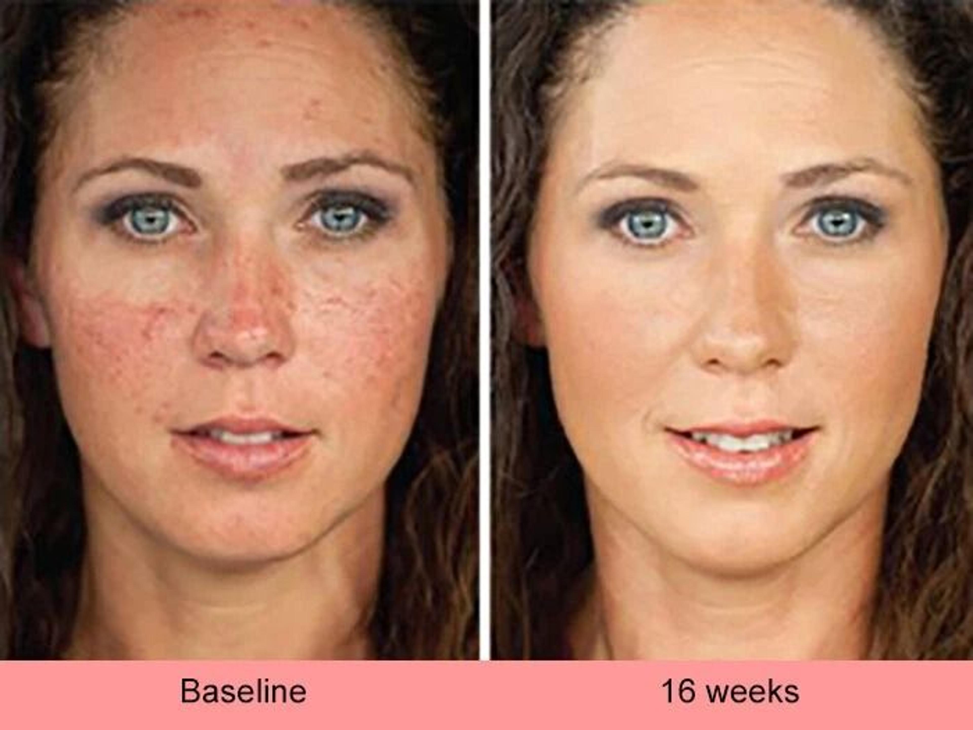 Kojic Acid Skin Whitening  Brightening Serum Dark Spot Corrector For Even Skin Tone 5