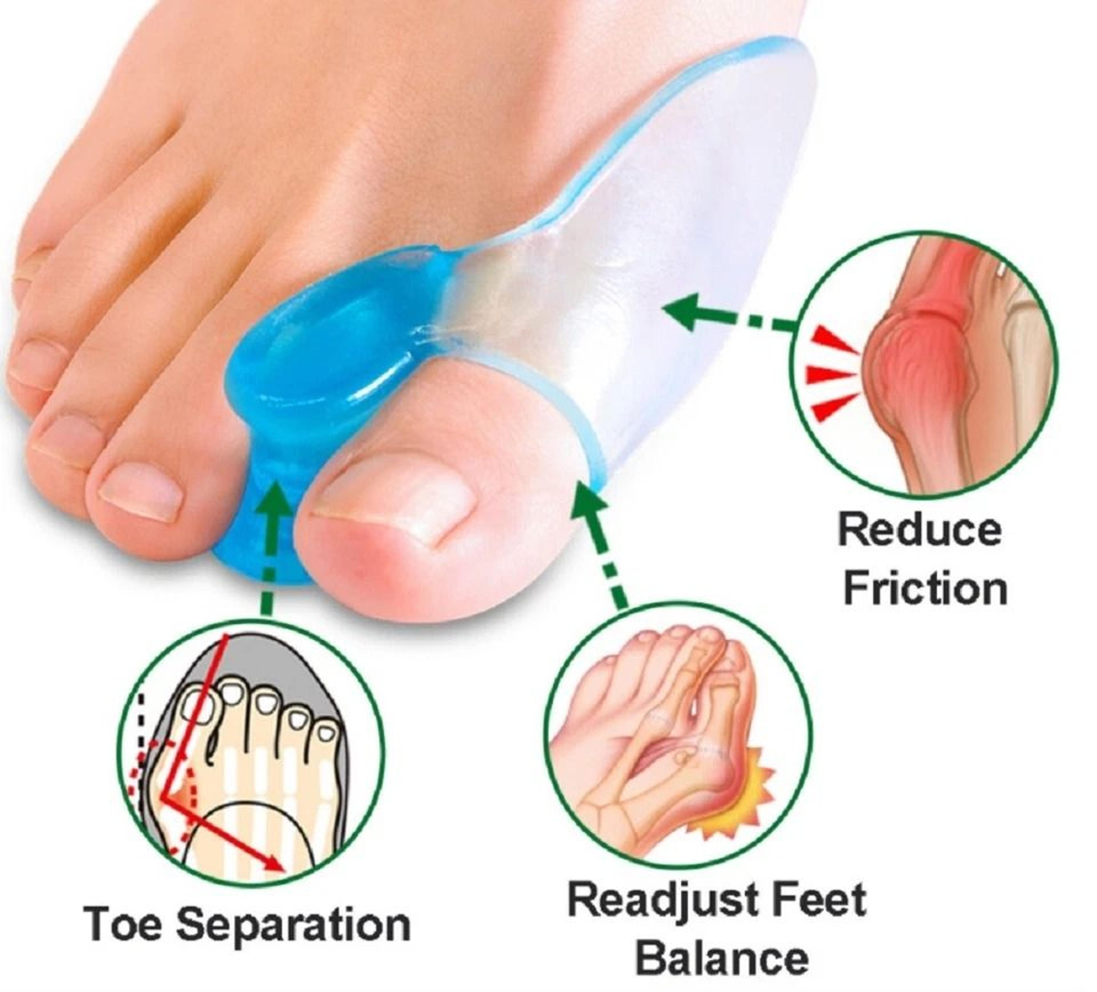 Silicone Gel Bunion Corrector  Toe Separator For Big Toe Foot Pain Relief 2