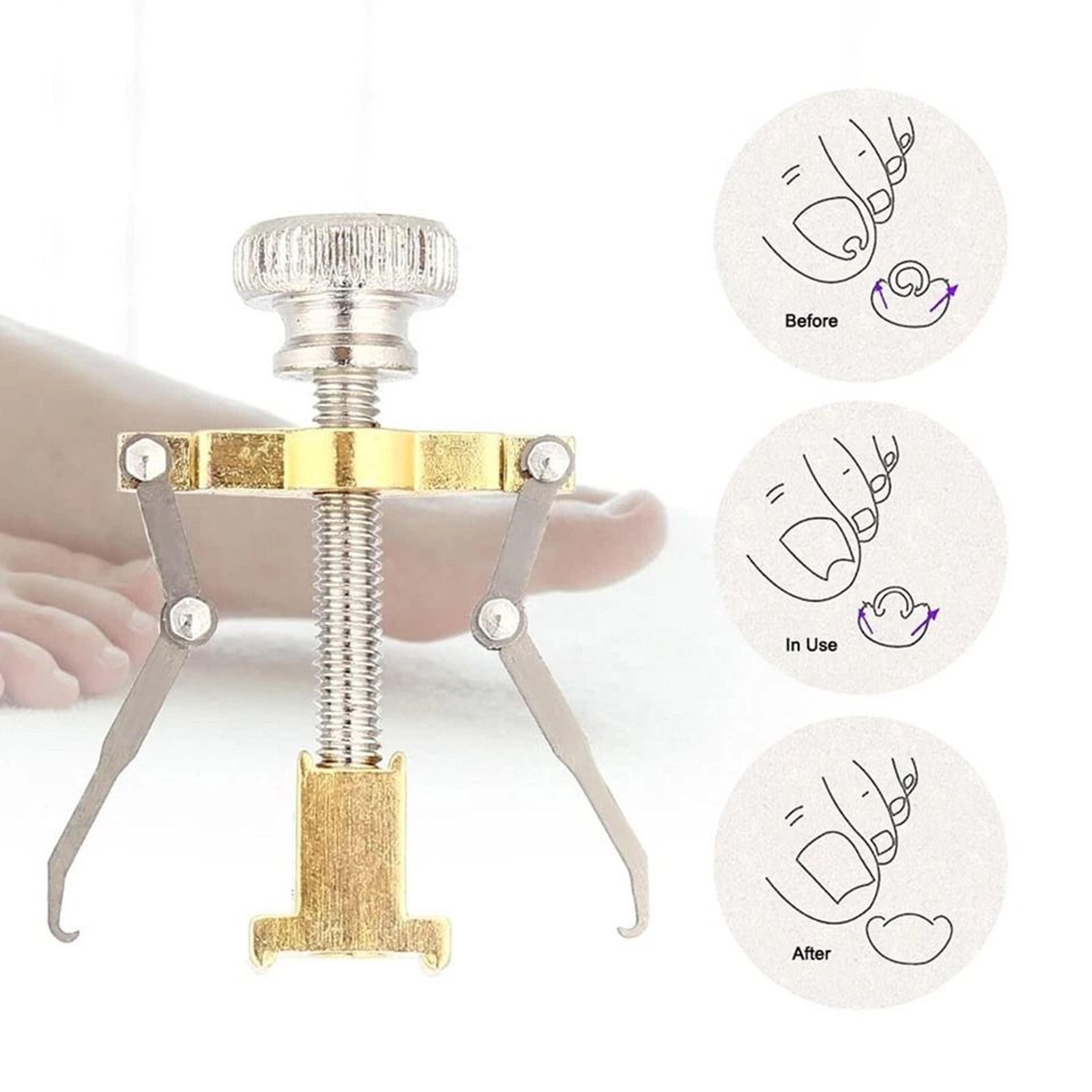 ingrown toenail correction lifter tool straightener & fixer for toe nail relief