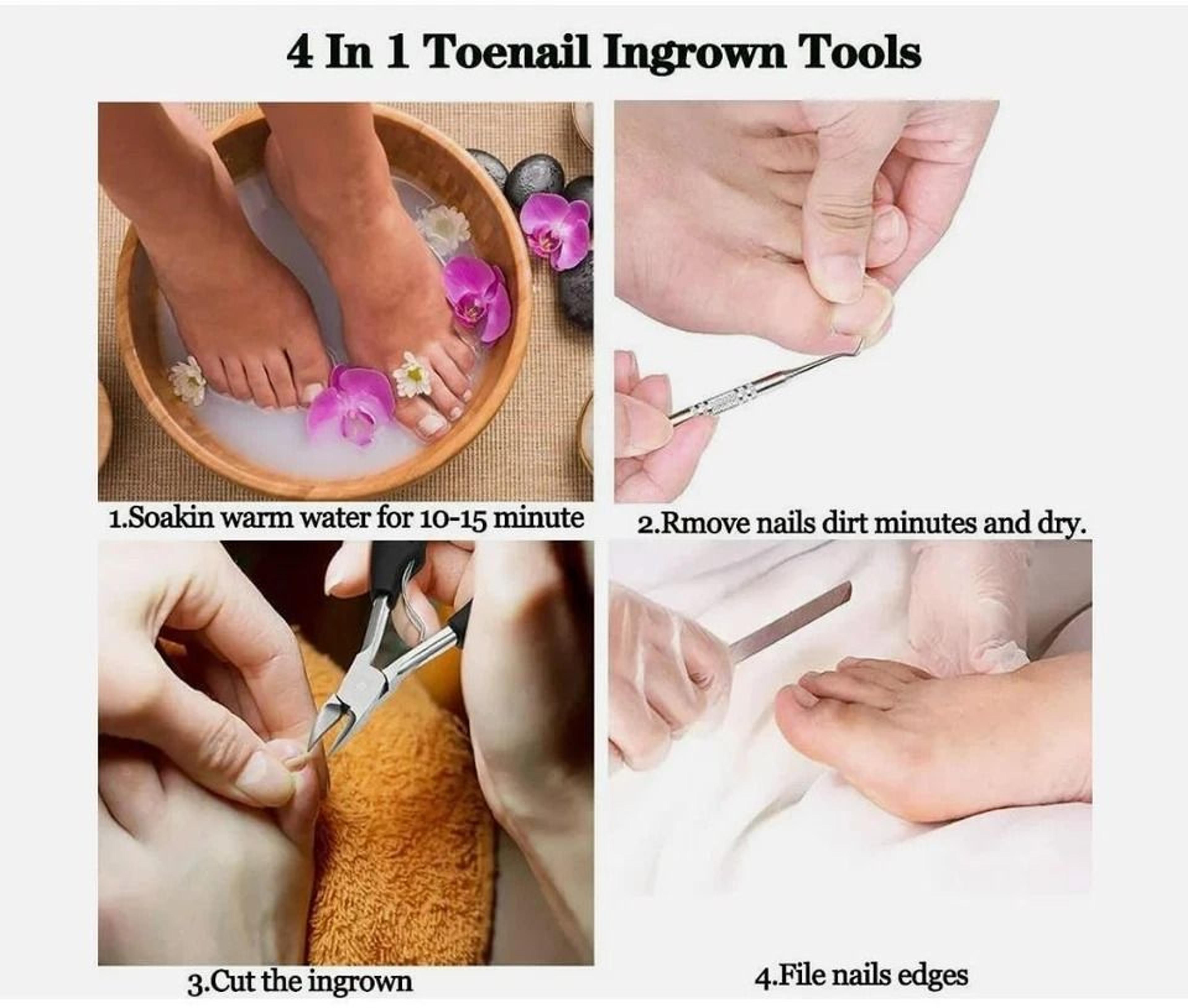 Heavy Duty Toenail Clippers For Thick Nails And Ingrown Toenails For Seniors 1