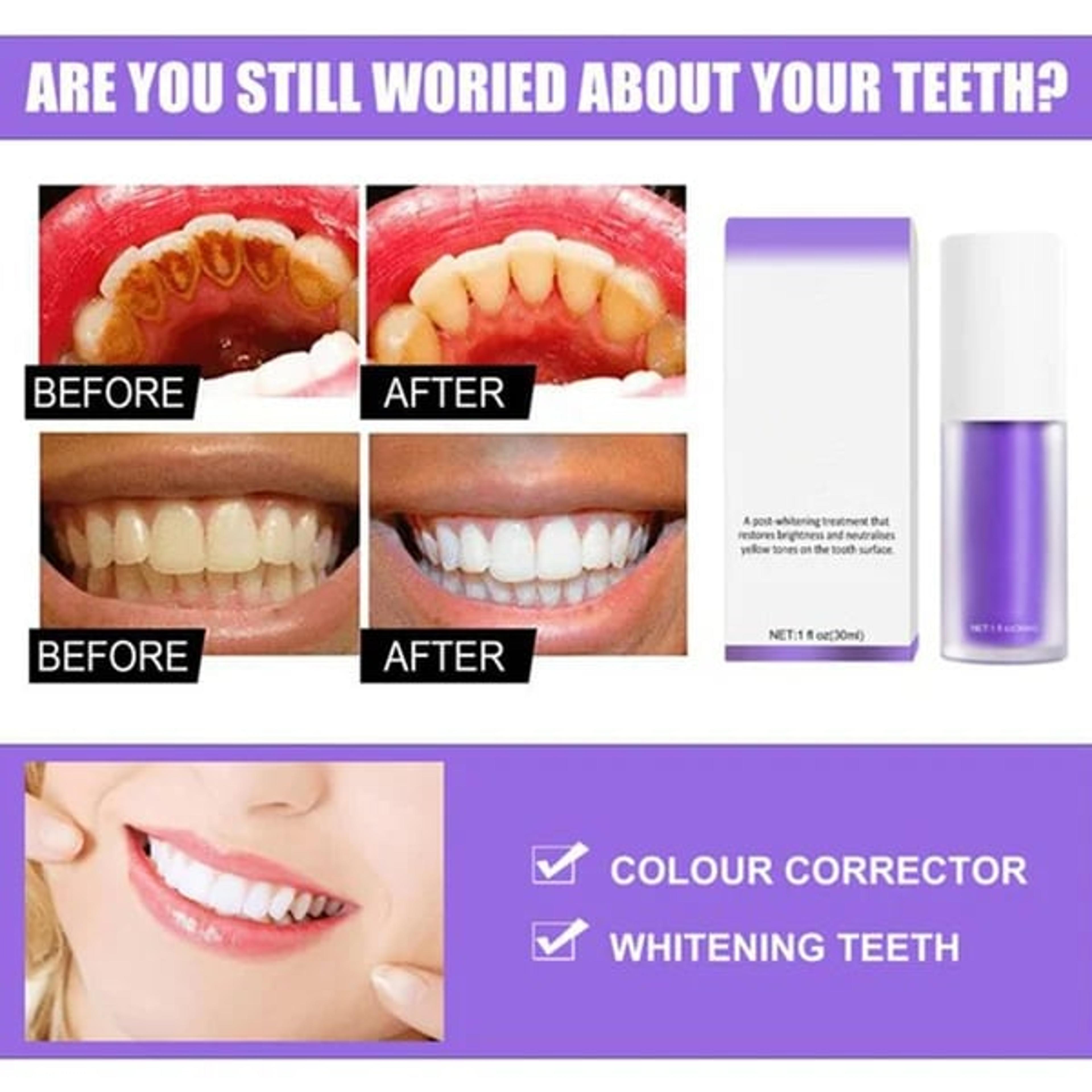 Teeth Colour Corrector Serum 1