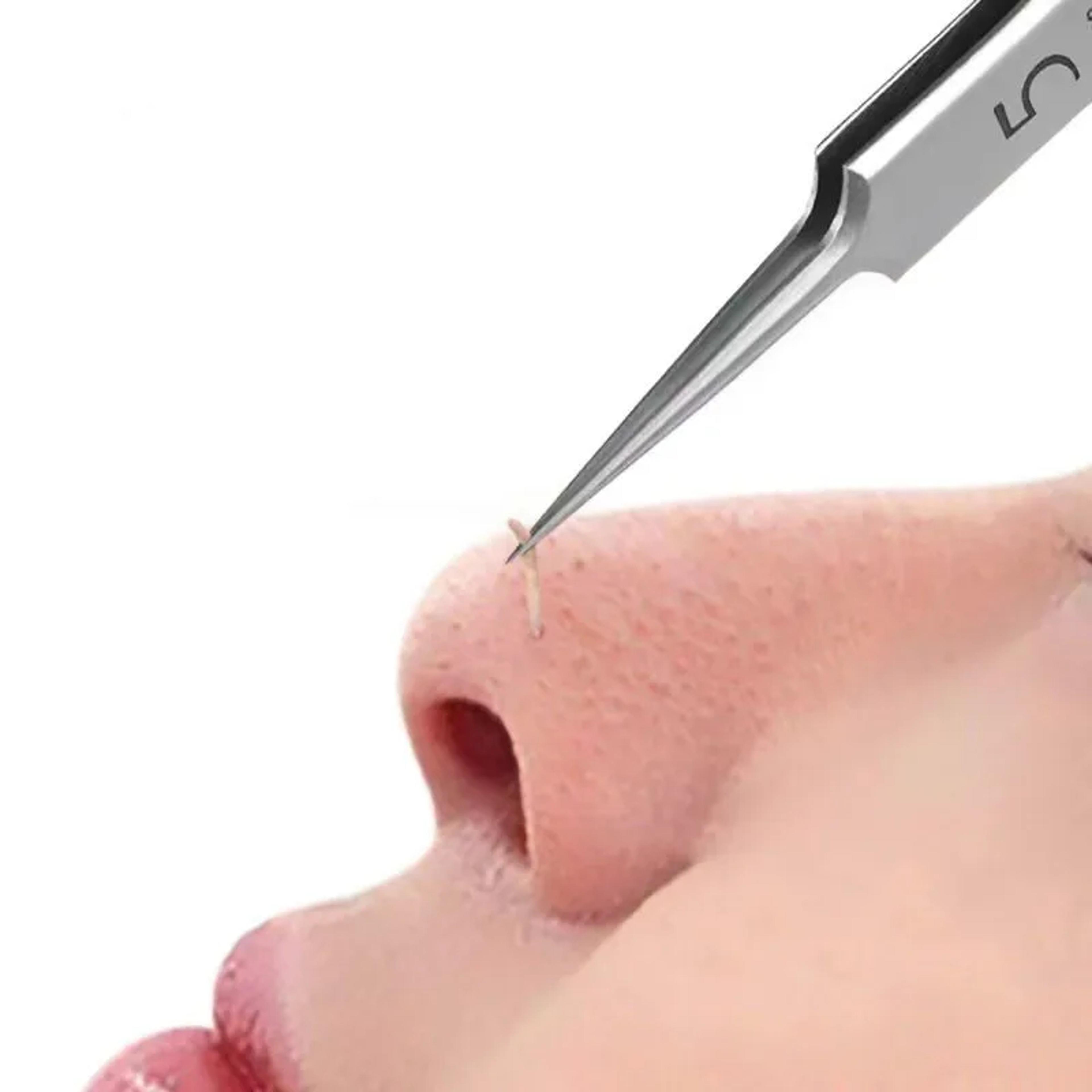 german ultra-fine pimple & blackhead removal tweezers - precision beauty tool for acne & skin care