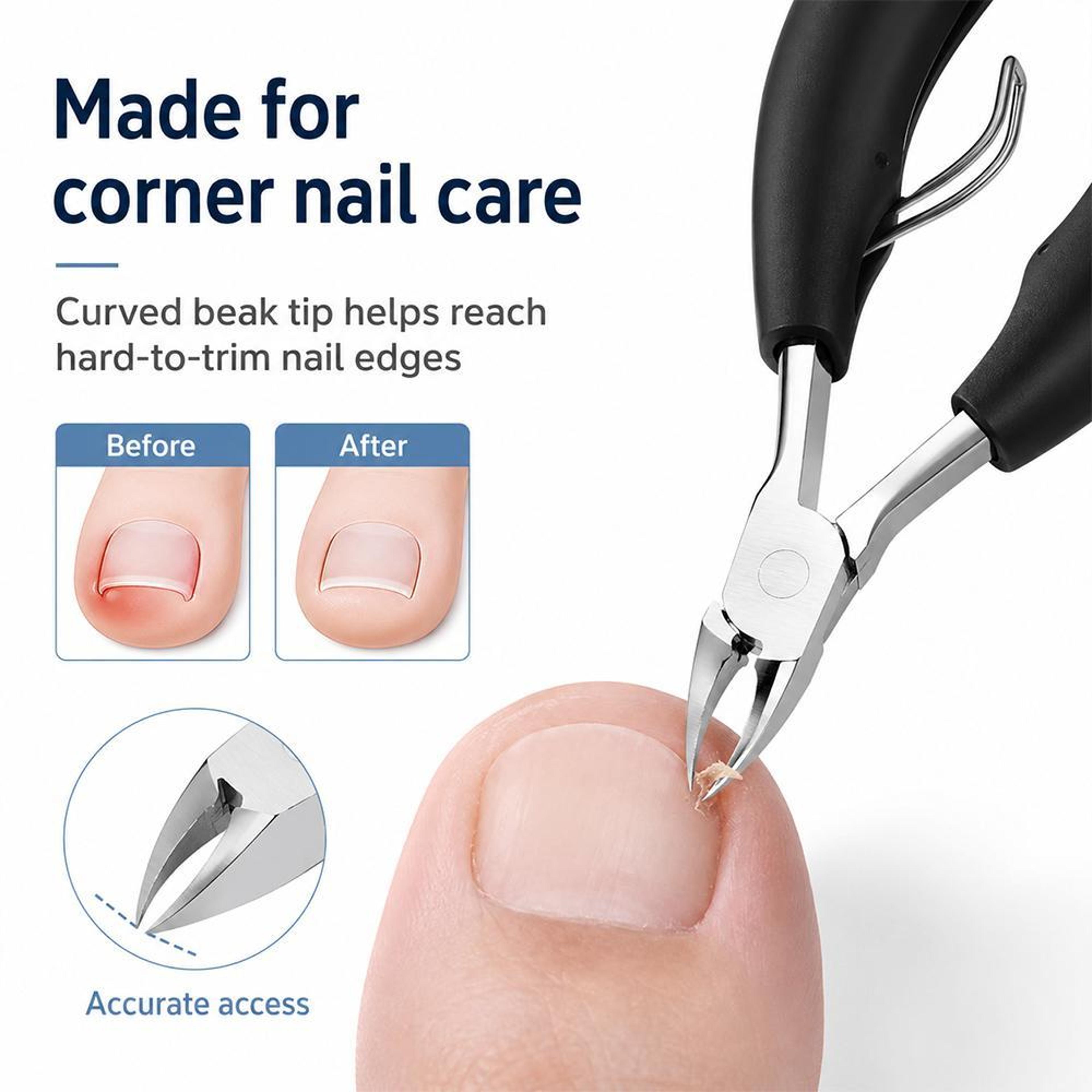 Professional Ingrown Toenail Clipper Stainless Steel Paronychia Nail Nipper For Thick And Curved Na 9