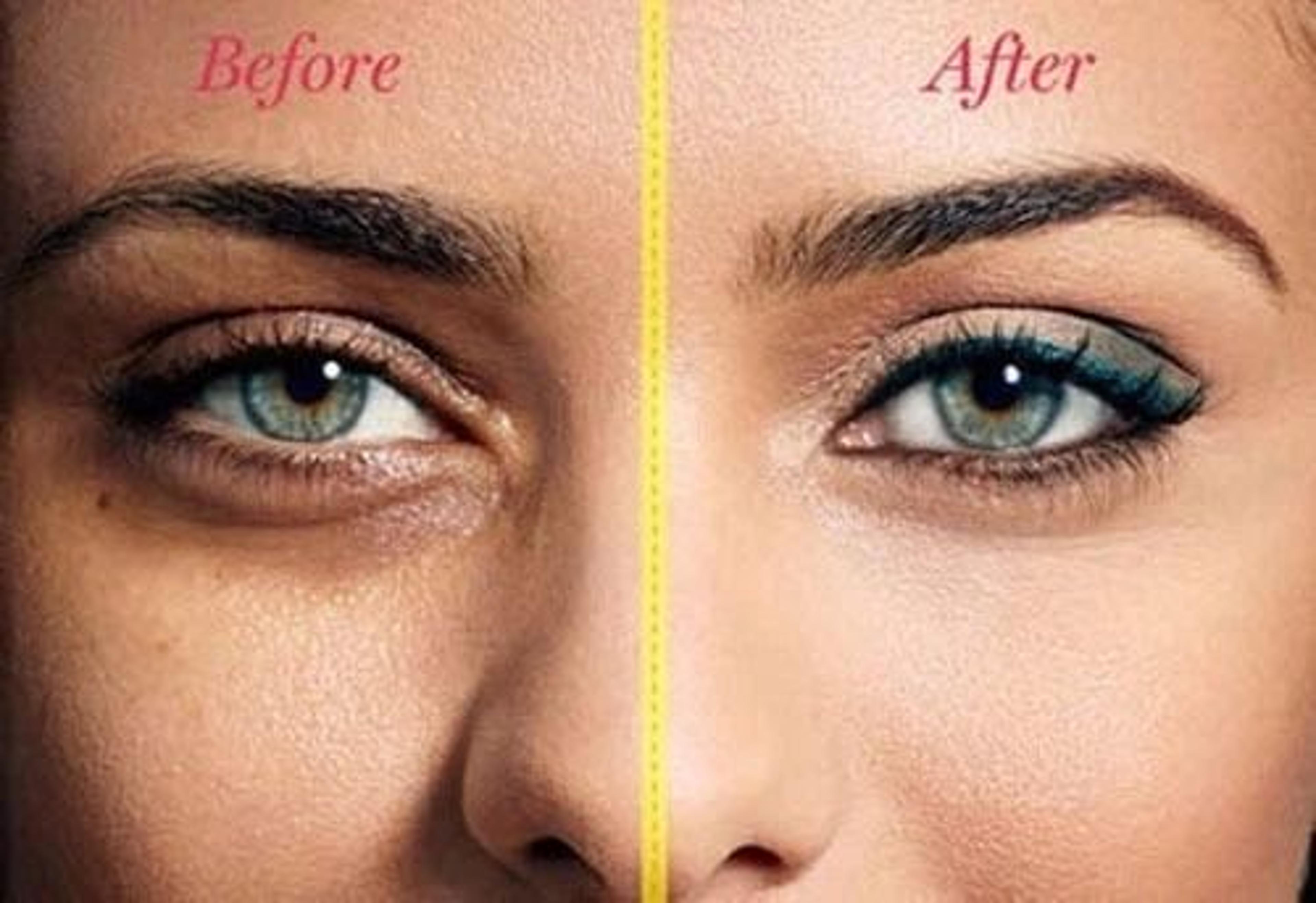 Hyaluronic Acid Under Eye Cream For Dark Circles Puffiness And Fine Lines 4