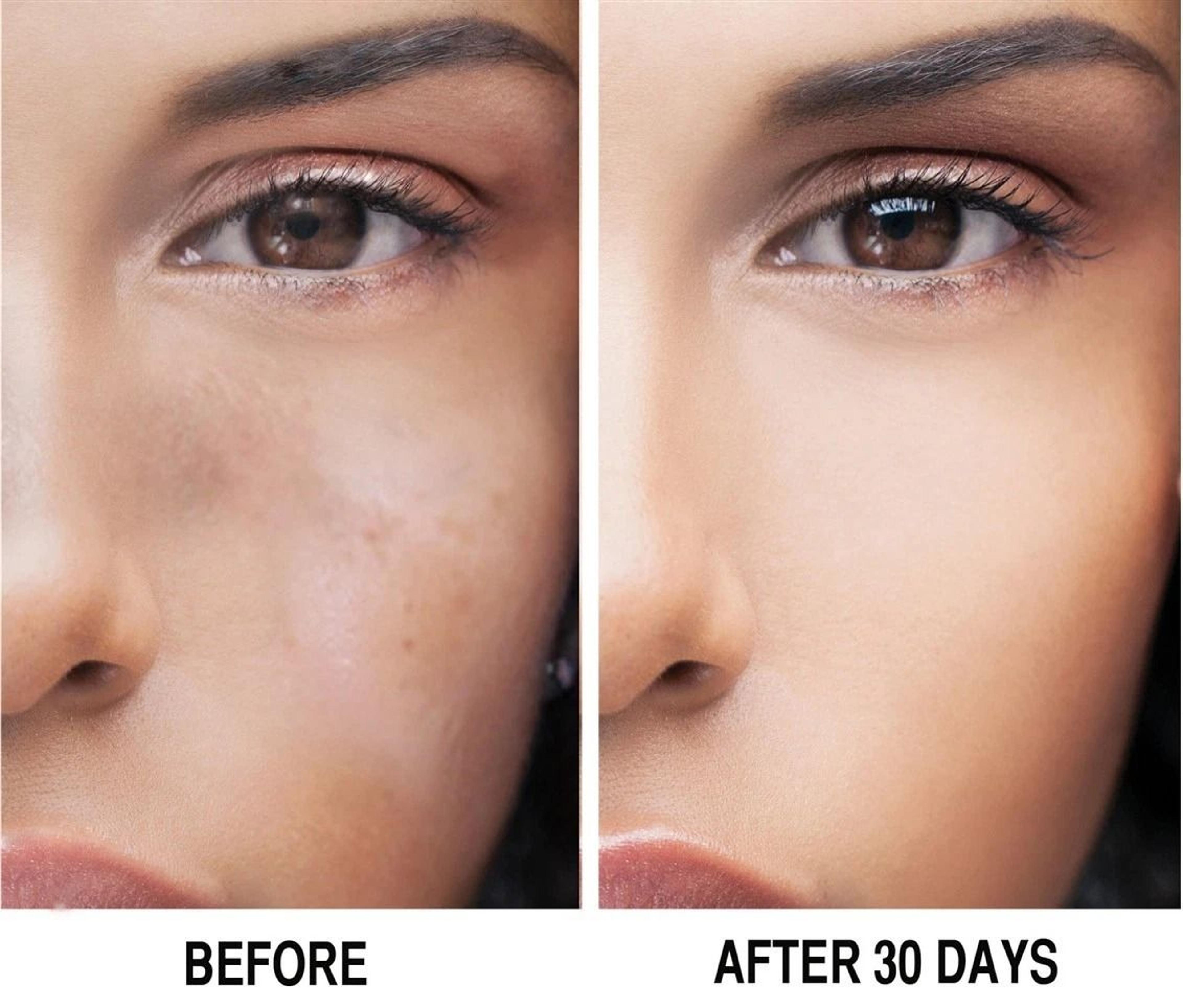 Kojic Acid Brightening Serum 1oz Dark Spot Treatment  Uneven Skin Tone Solution 4