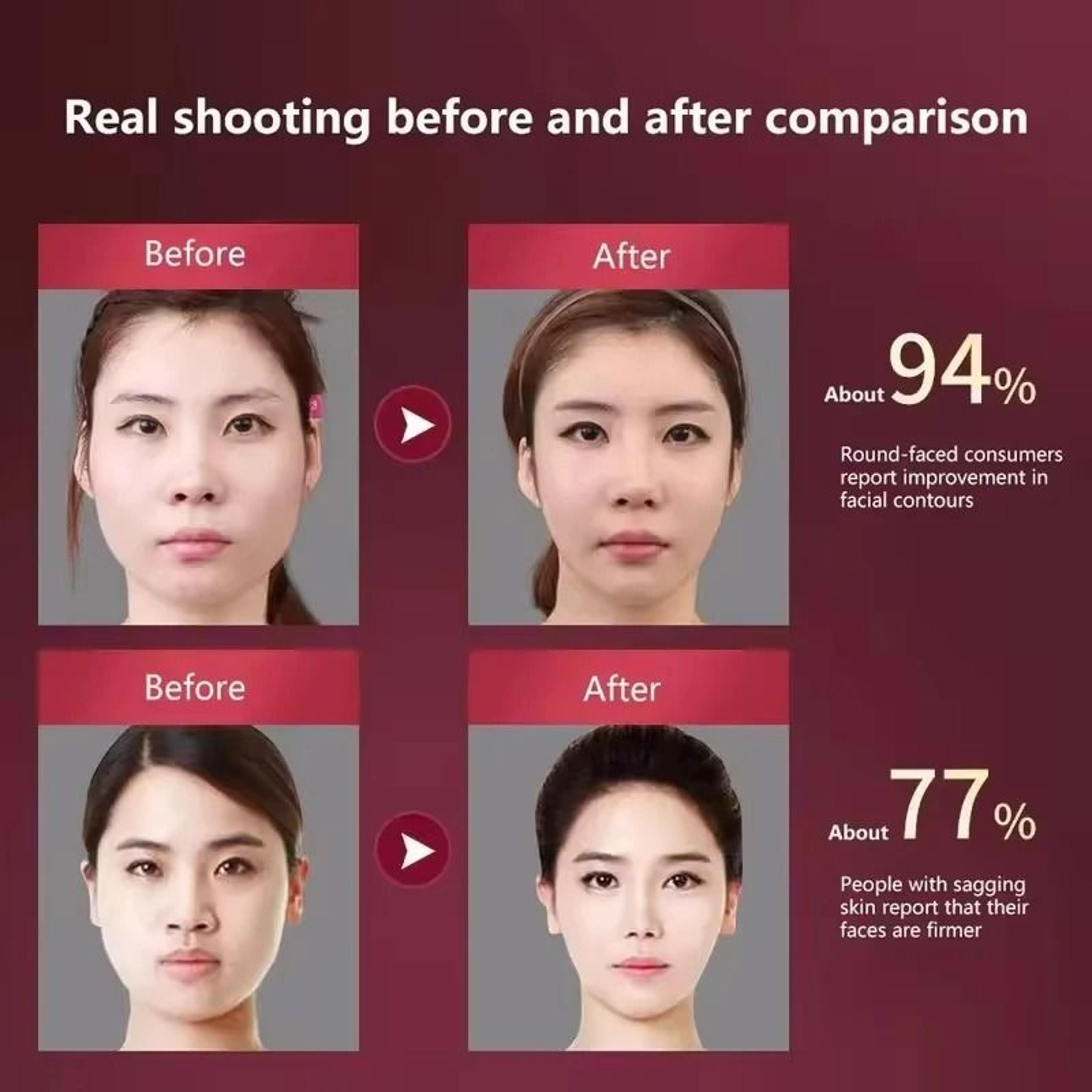 Heated VShape Facial Lifting Vibration Massager 6