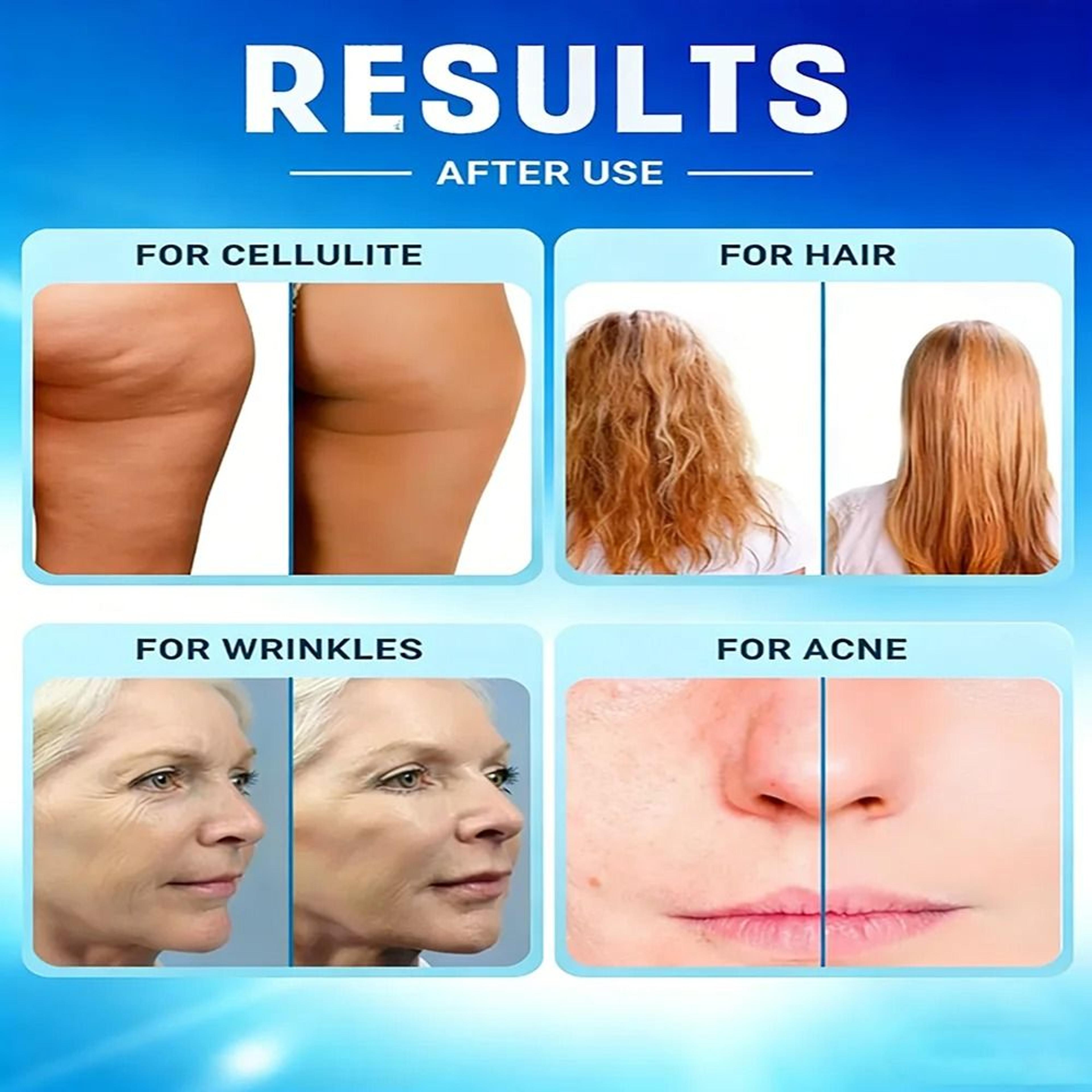 4in1 High Frequency Facial Wand With Glass Electrodes For Skin Care 4