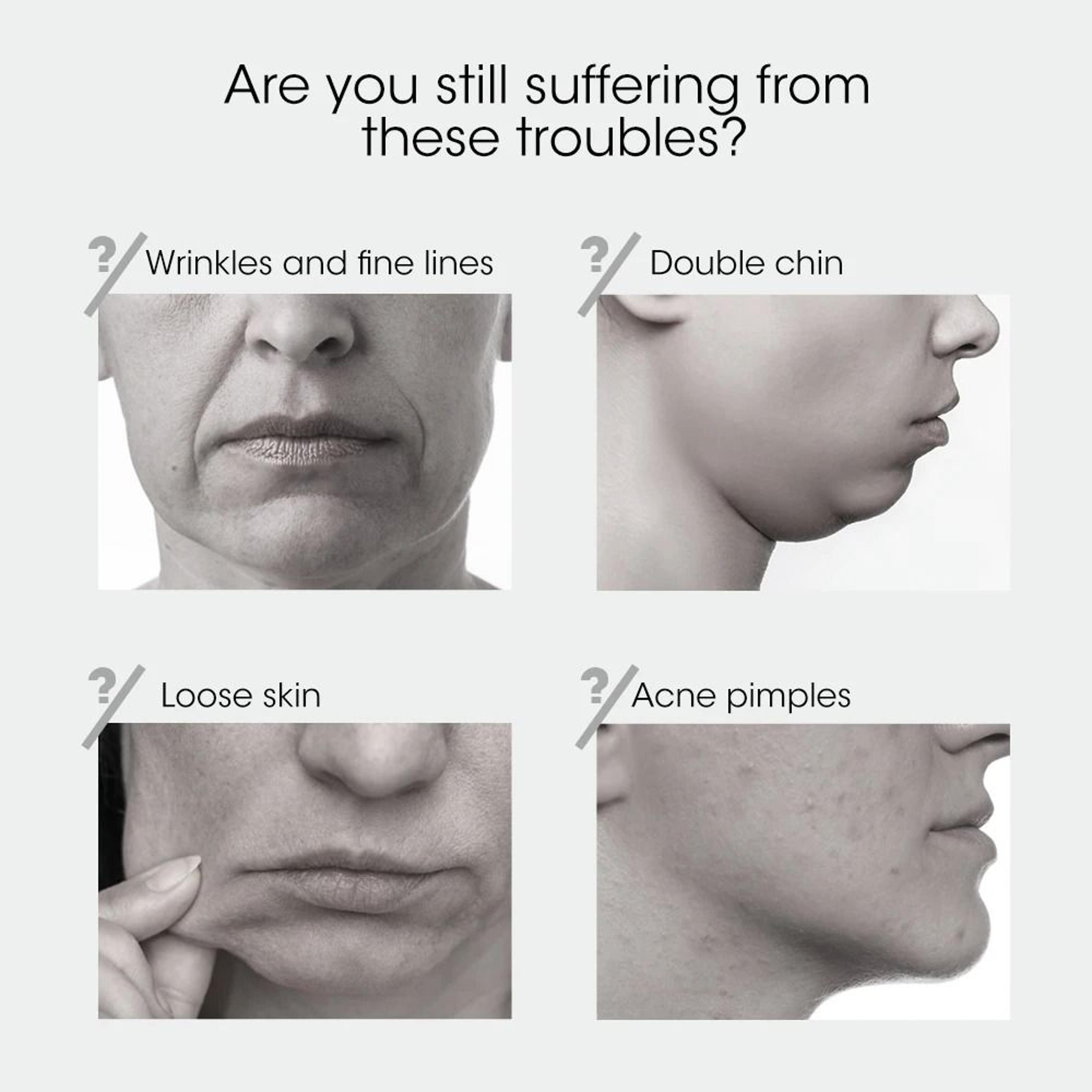Face Lifting Device Red Light Skin Rejuvenation V Face Massager Double Chin Lift Up Remote Control 5