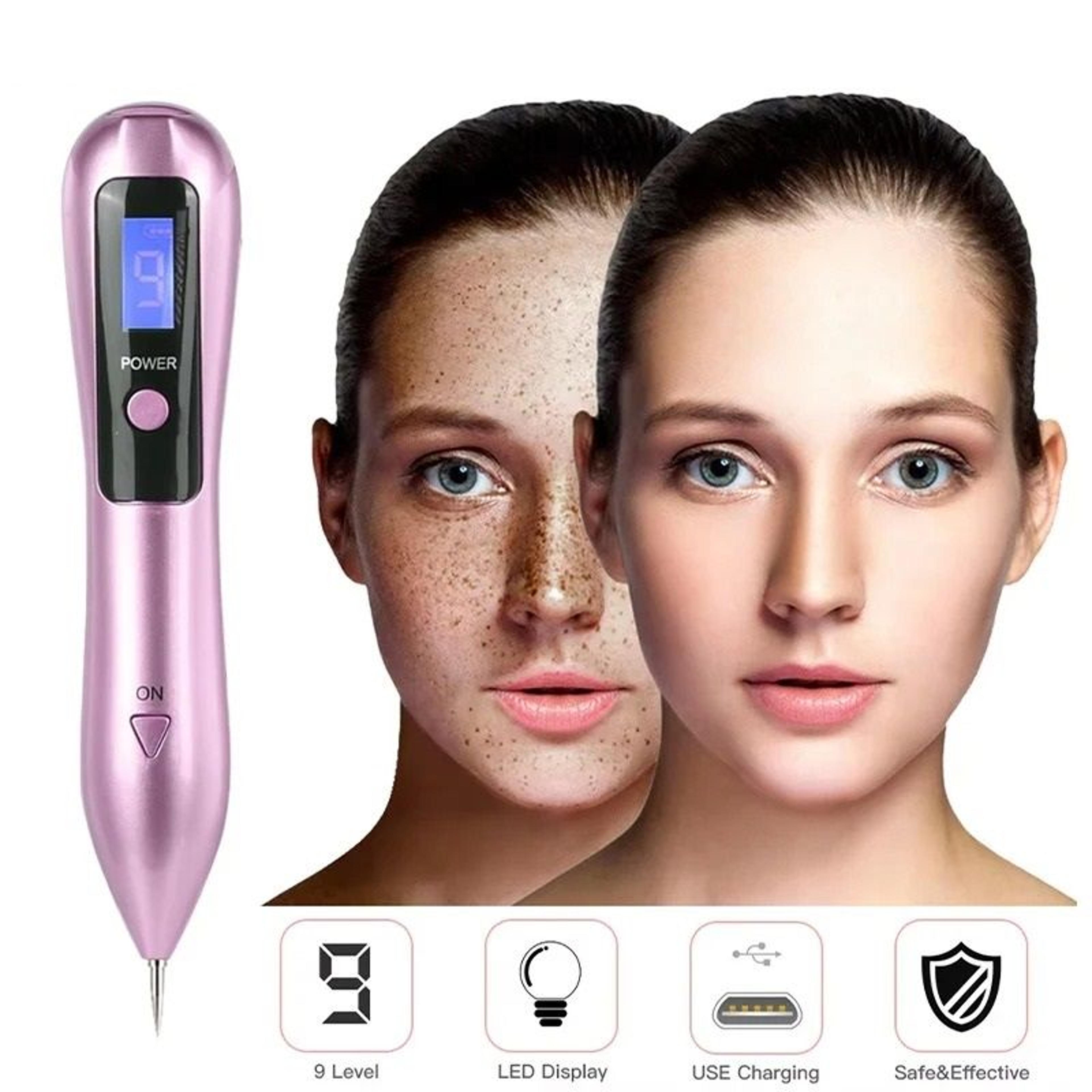 plasma beauty pen for skin spot removal