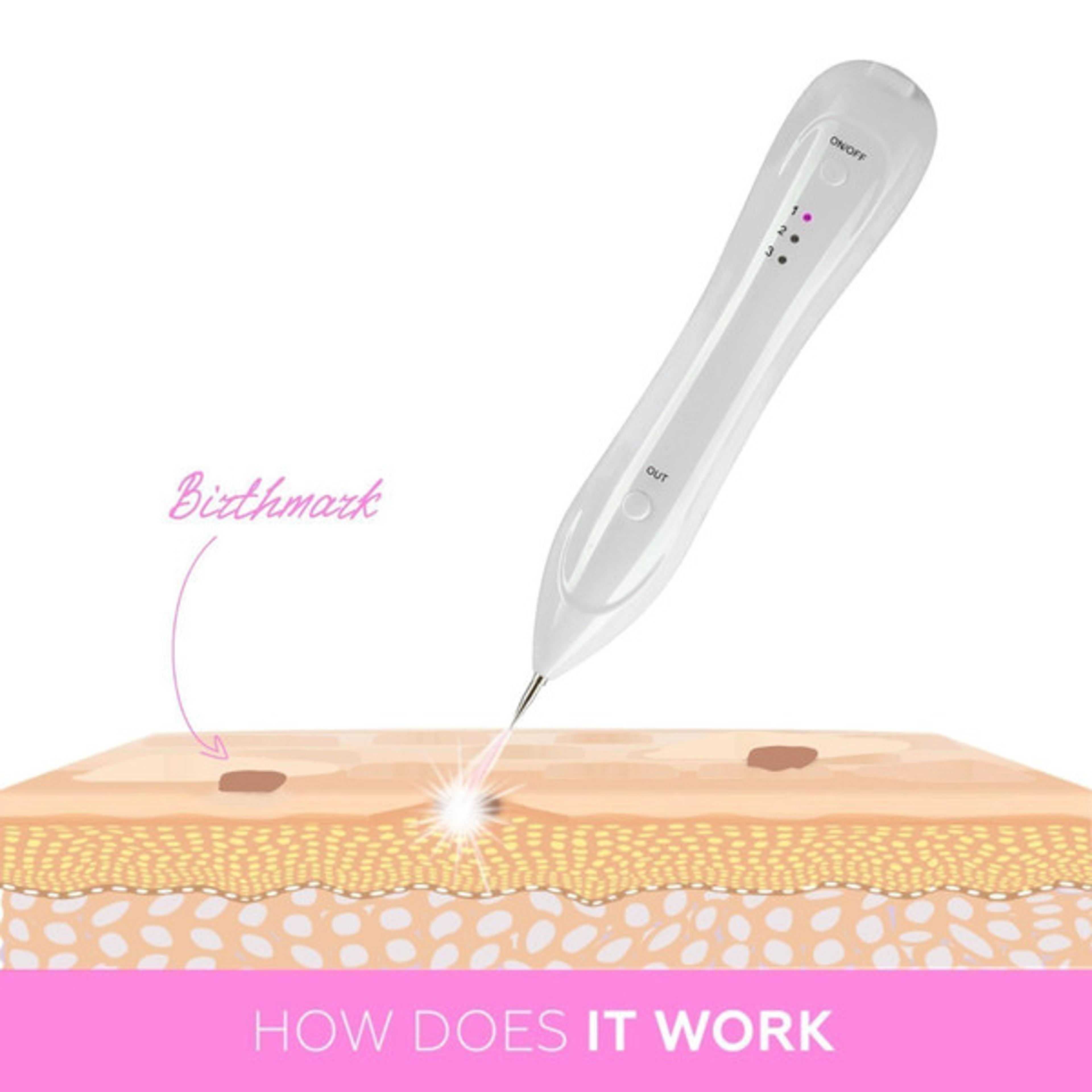 Easy skin tag elimination device