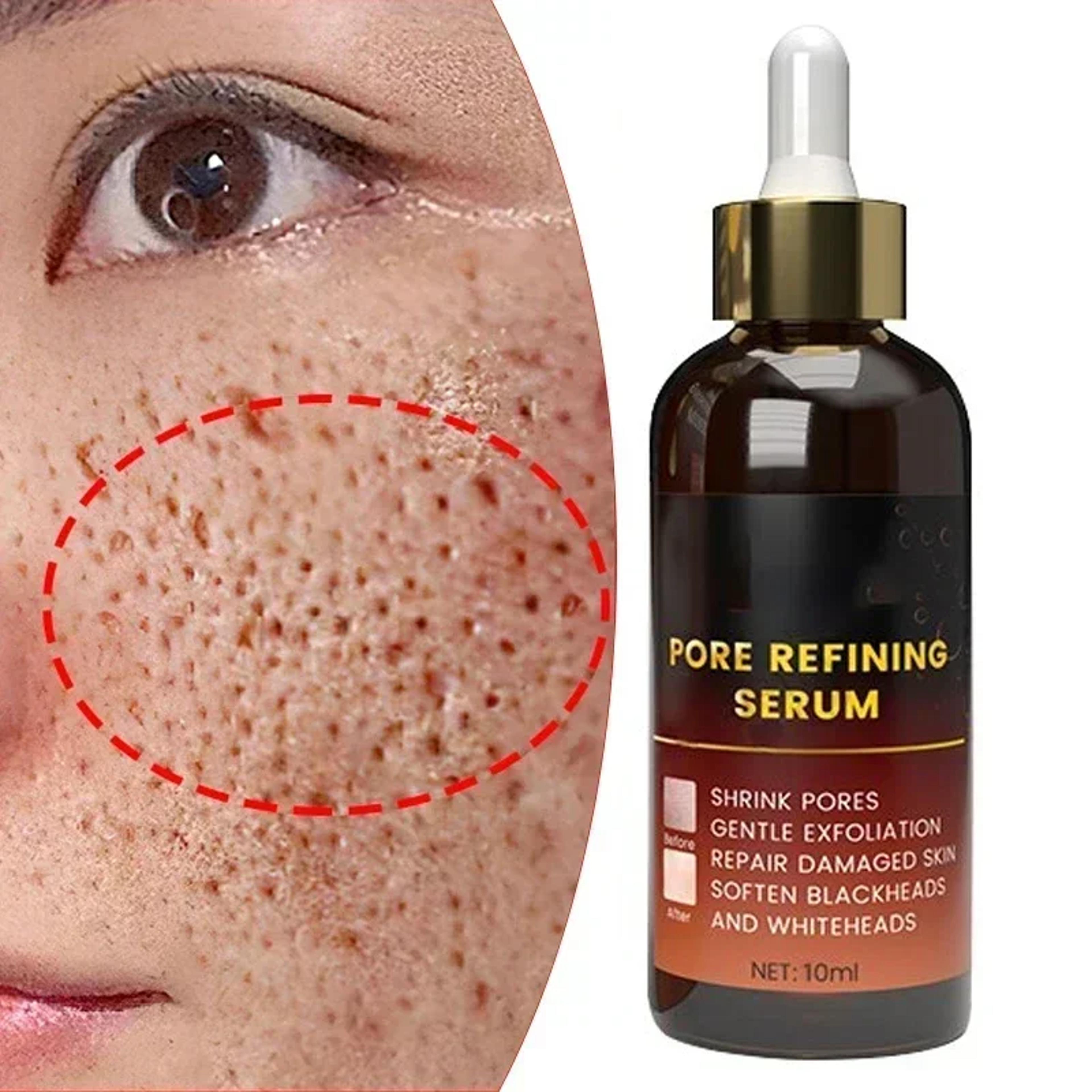 pore refining face serum for blackheads and oil control with moisturizing care