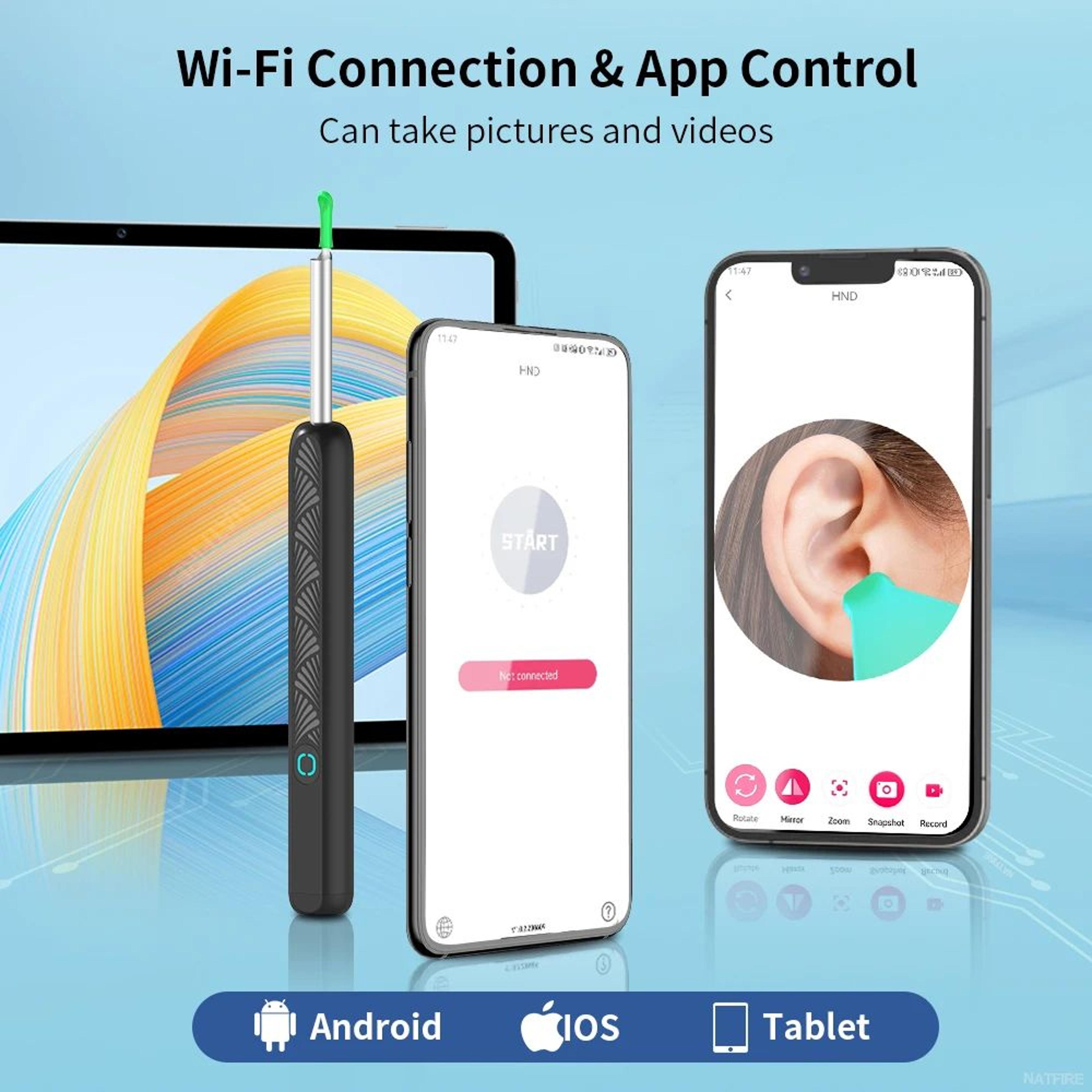 ClearView Wireless Ear Cleaner With Camera  HD Otoscope Ear Wax Removal Tool With LED Lights  USBC 1