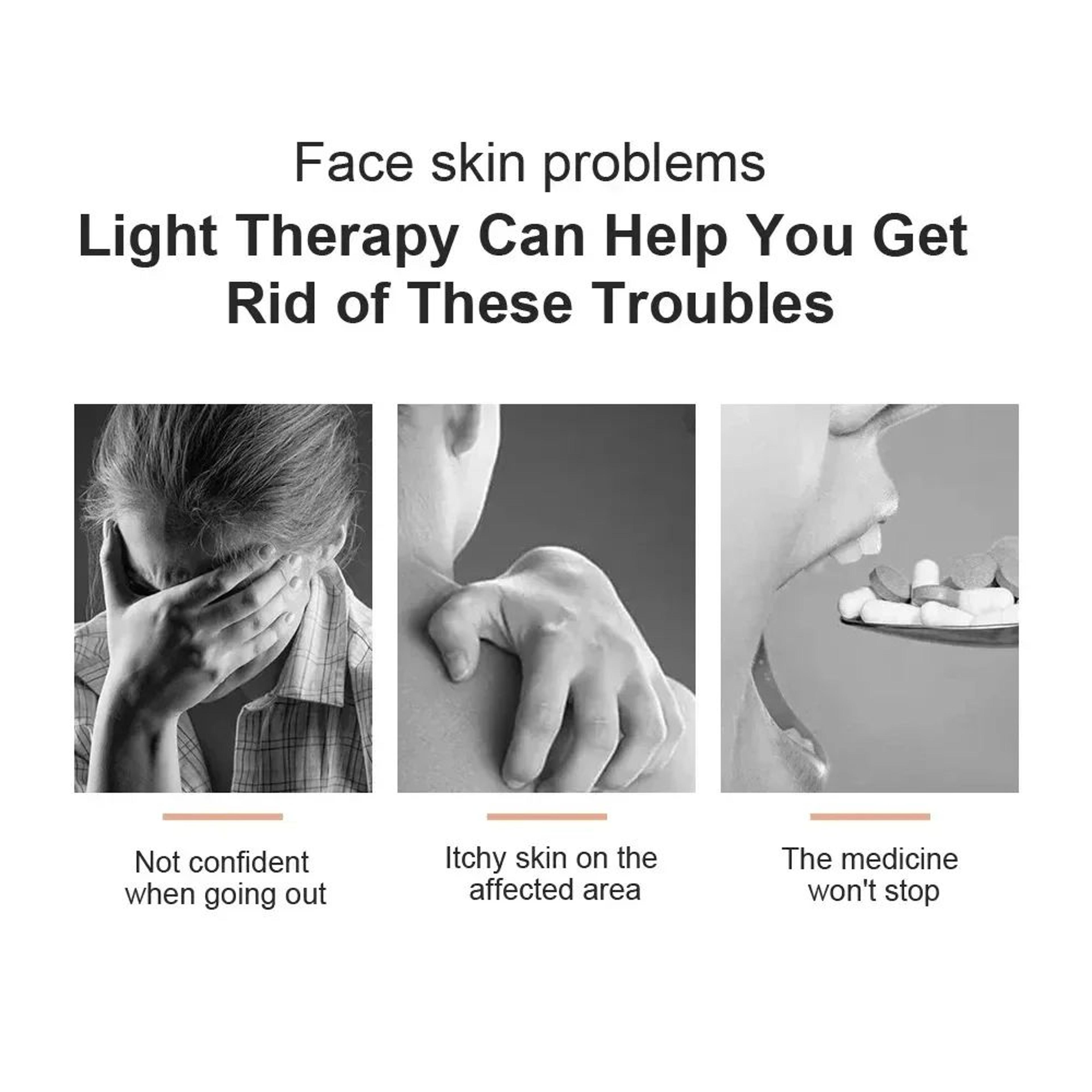 311NM Narrowband UVB Phototherapy Lamp  Portable Skin Therapy Light For Psoriasis Vitiligo  Eczema  2