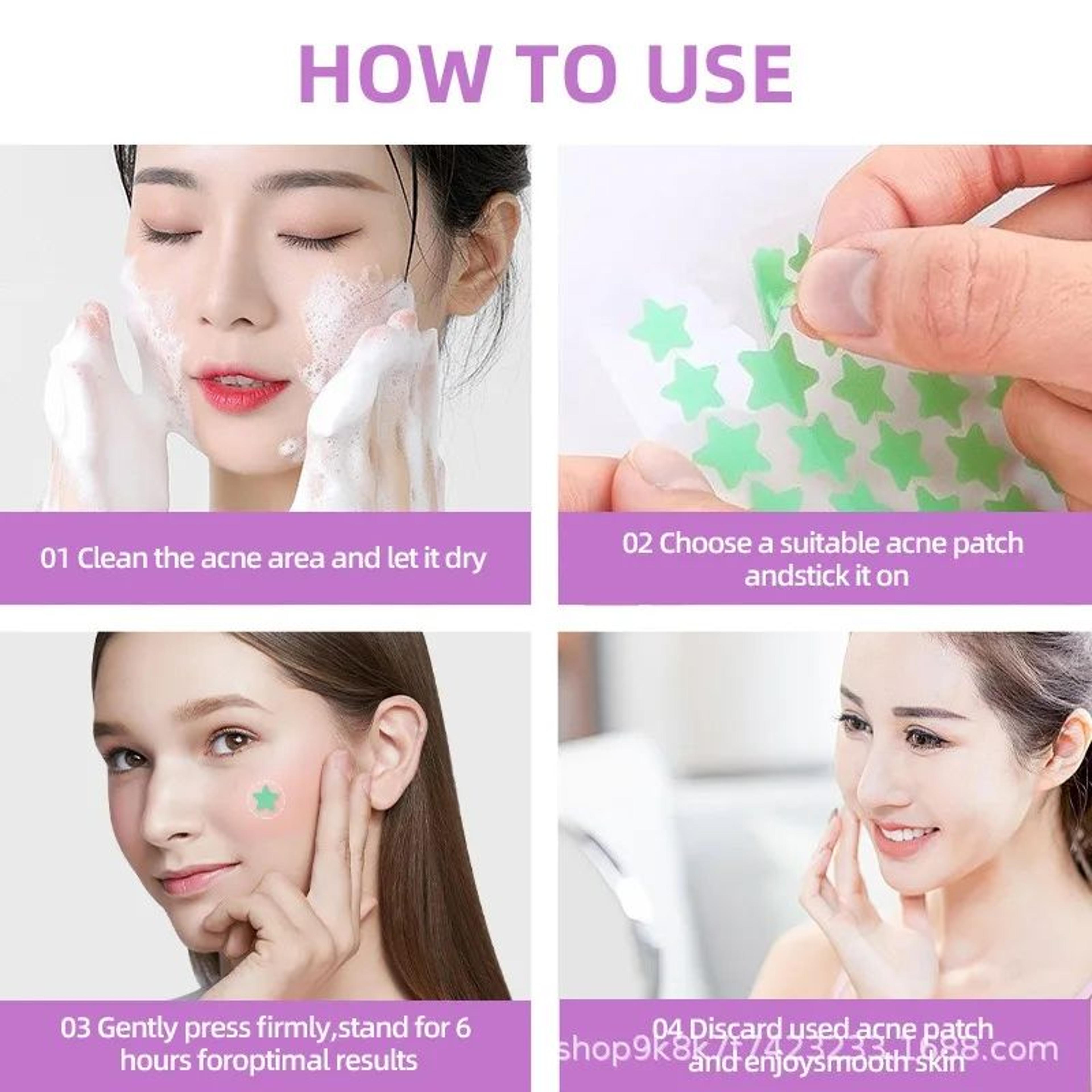 280pcs Star Shaped Pimple Patches  Colorful Invisible Acne Spot Stickers For Blemish Cover Hydrocol 4