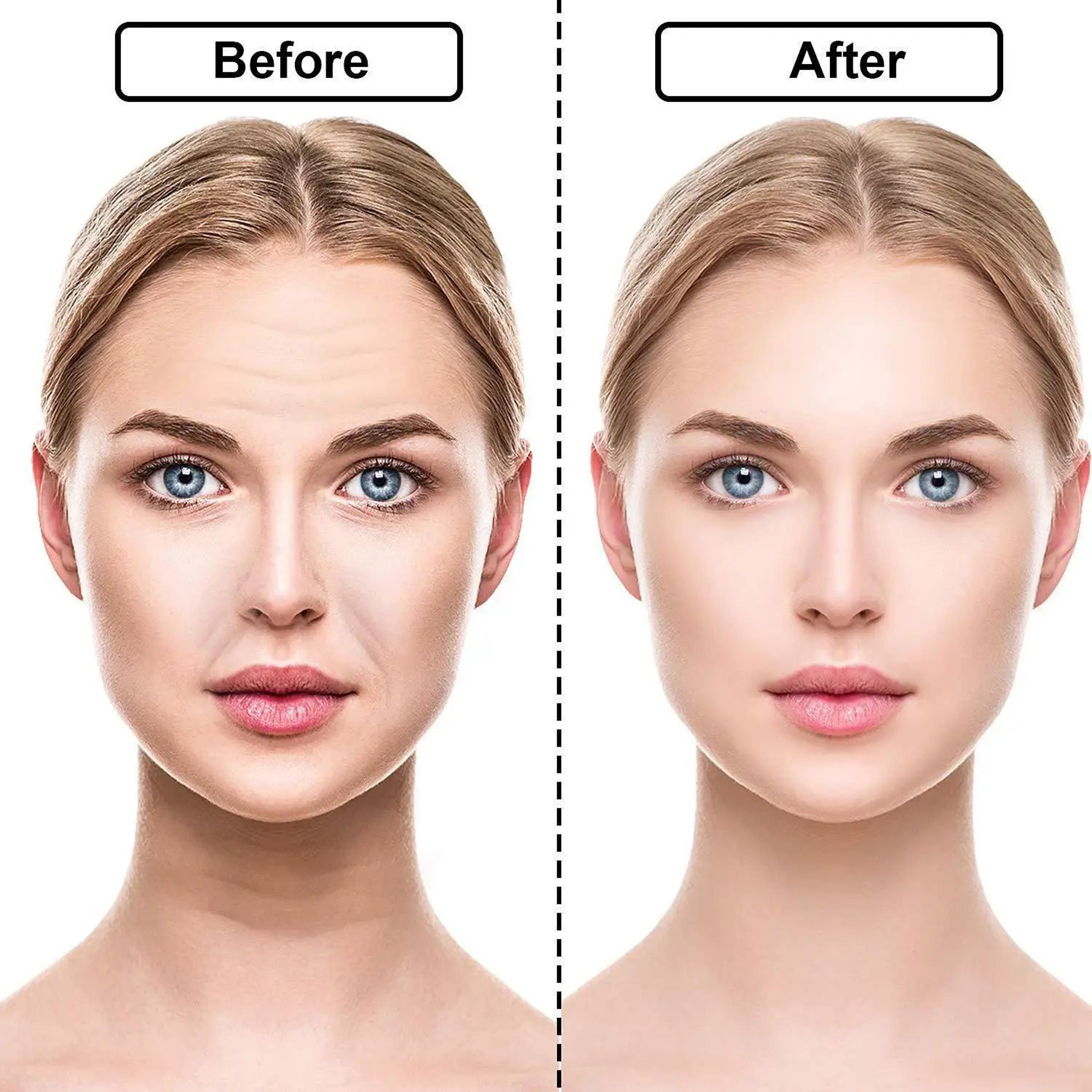 Reusable Silicone Anti Wrinkle Face And Neck Patches Set 4