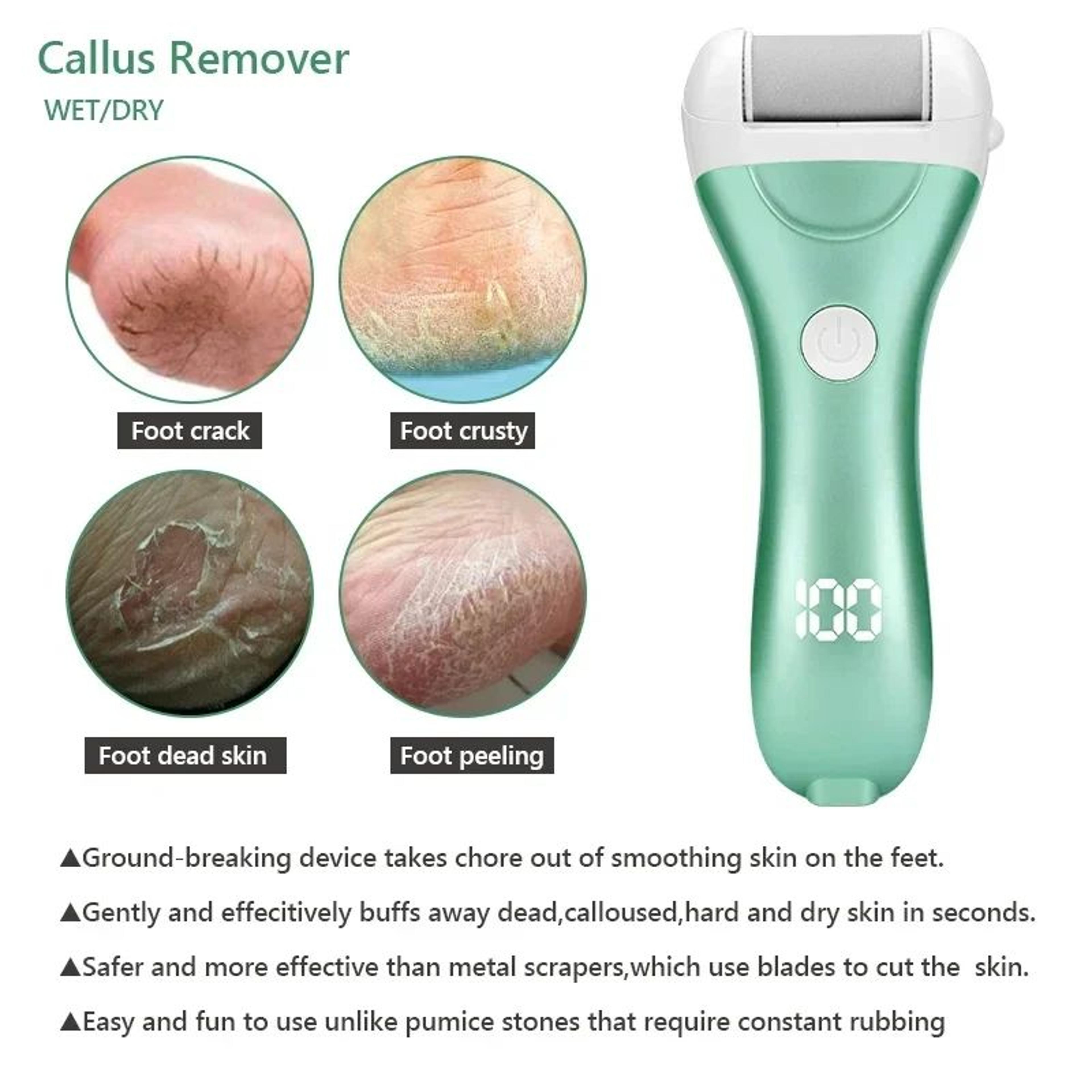 Rechargeable Electric Foot File Callus Remover Pedicure Tool With LED Power Display And 3 Roller He 4