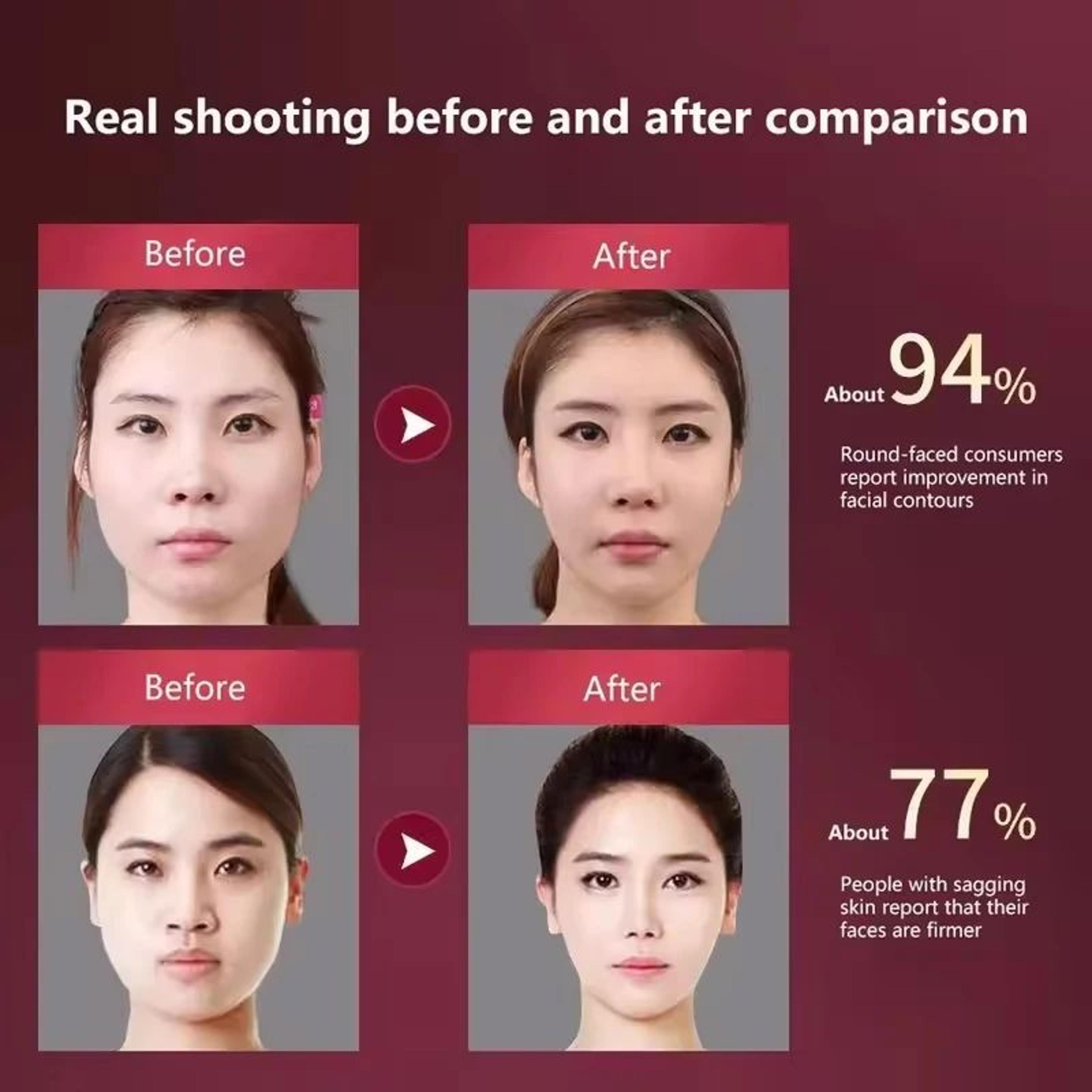 VLine Electric Facial Massager For Face Lifting And Jawline Sculpting With Vibration Therapy 4