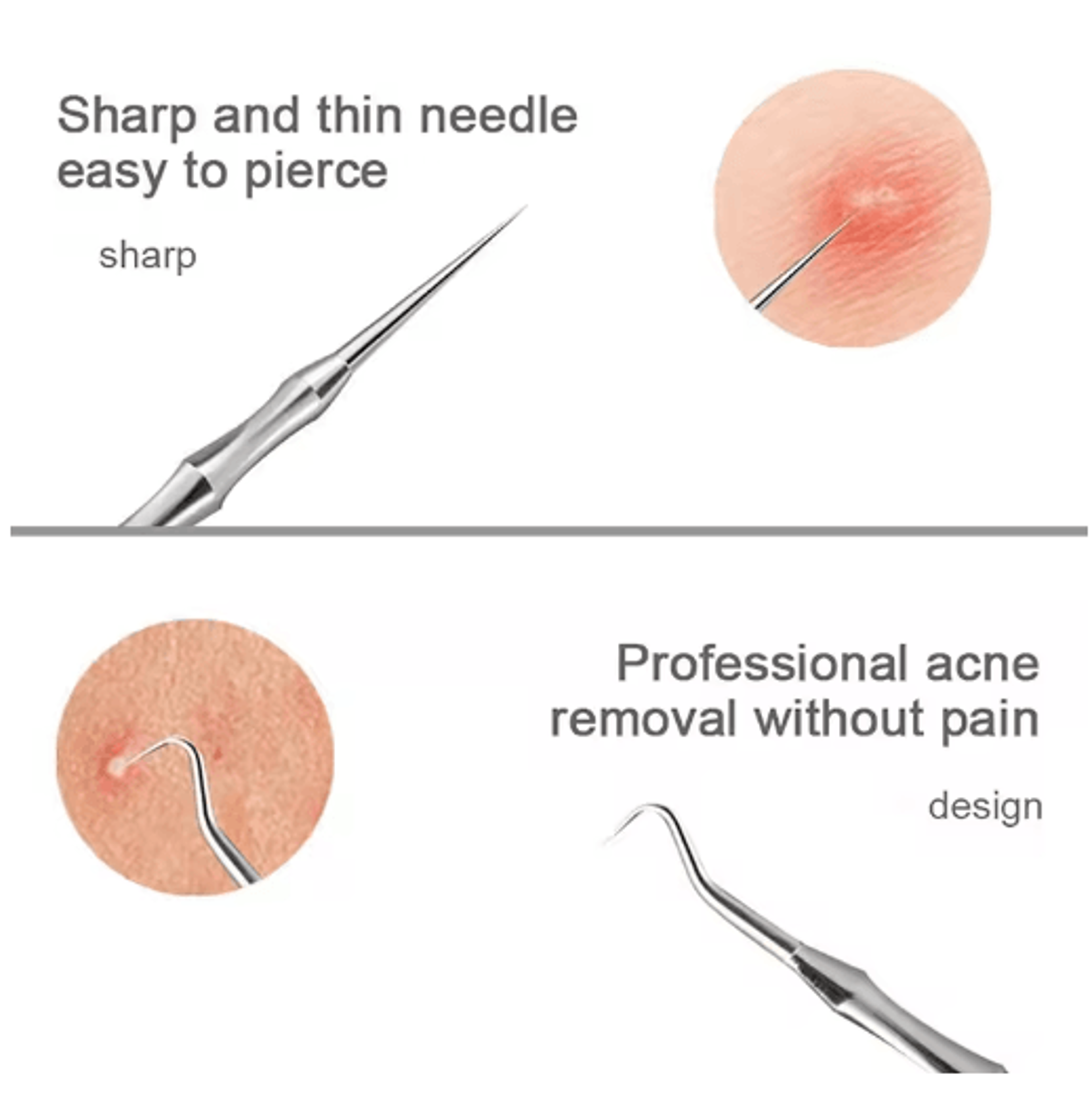 Stainless Steel Blackhead Remover  Milia Extractor Tool  Precision Pore Cleaning Kit 6
