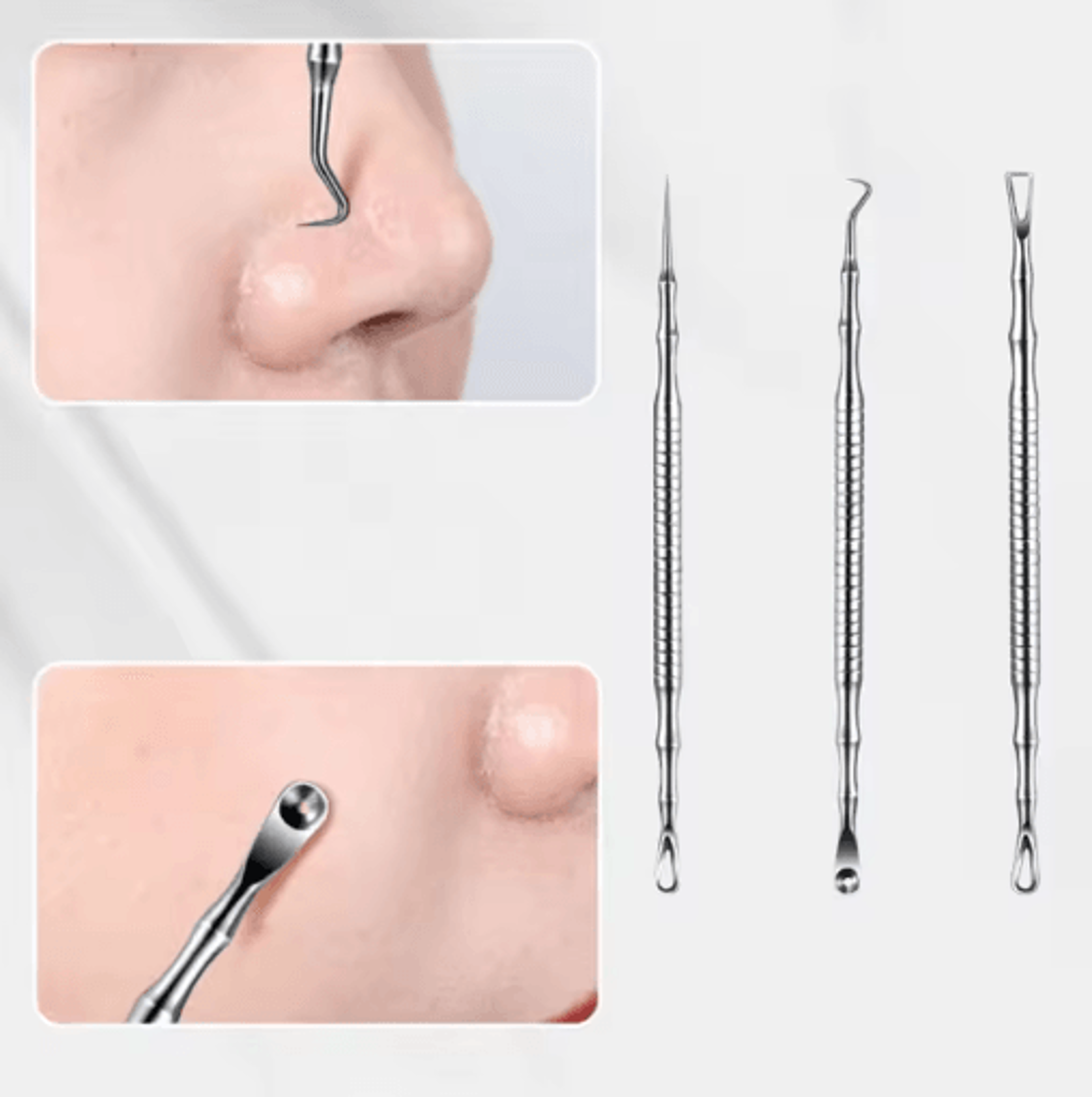 Stainless Steel Blackhead Remover  Milia Extractor Tool  Precision Pore Cleaning Kit 9