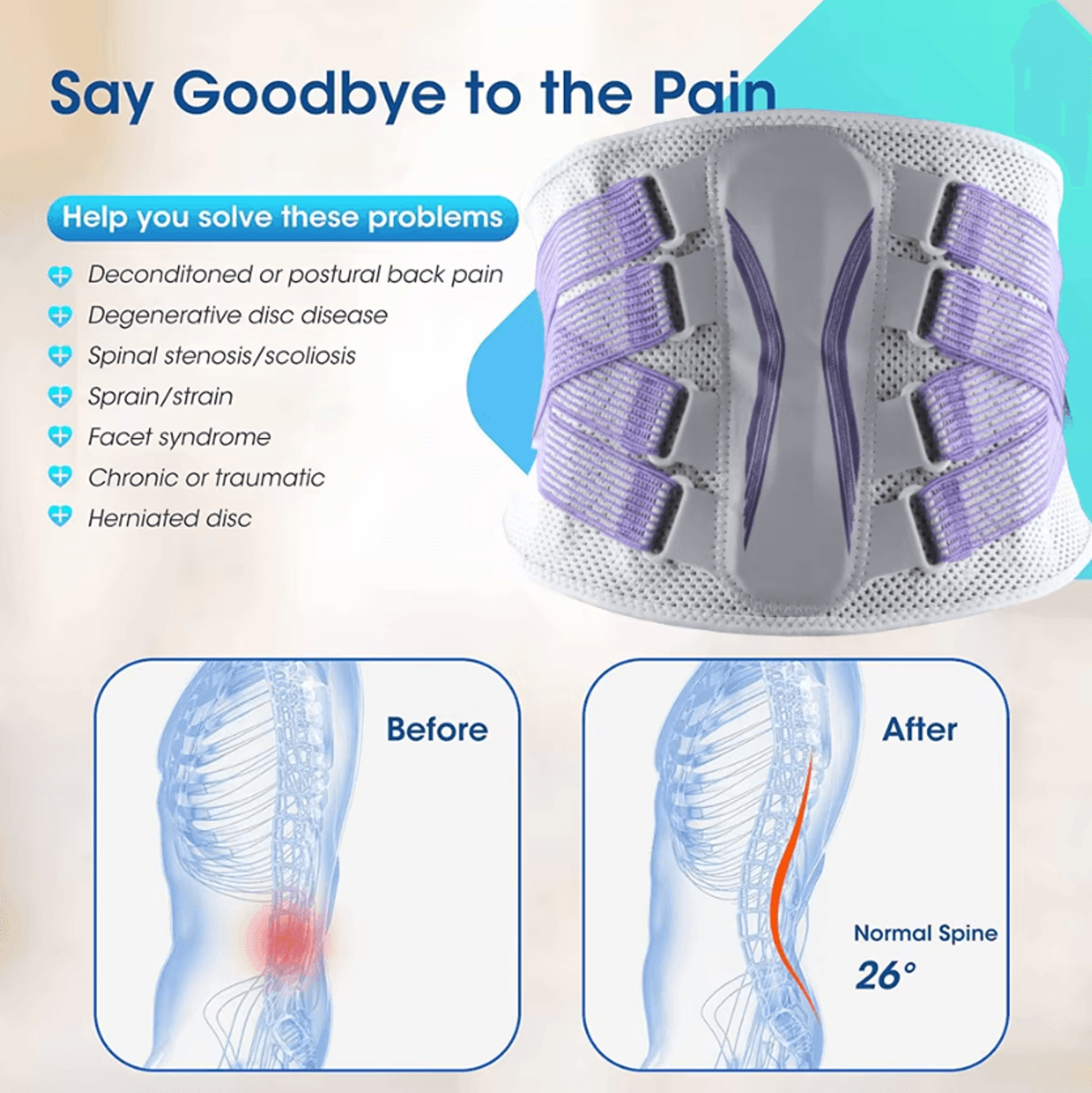 Back Brace For Men And Women Breathable Lumbar Support Belt For Everyday Comfort 1