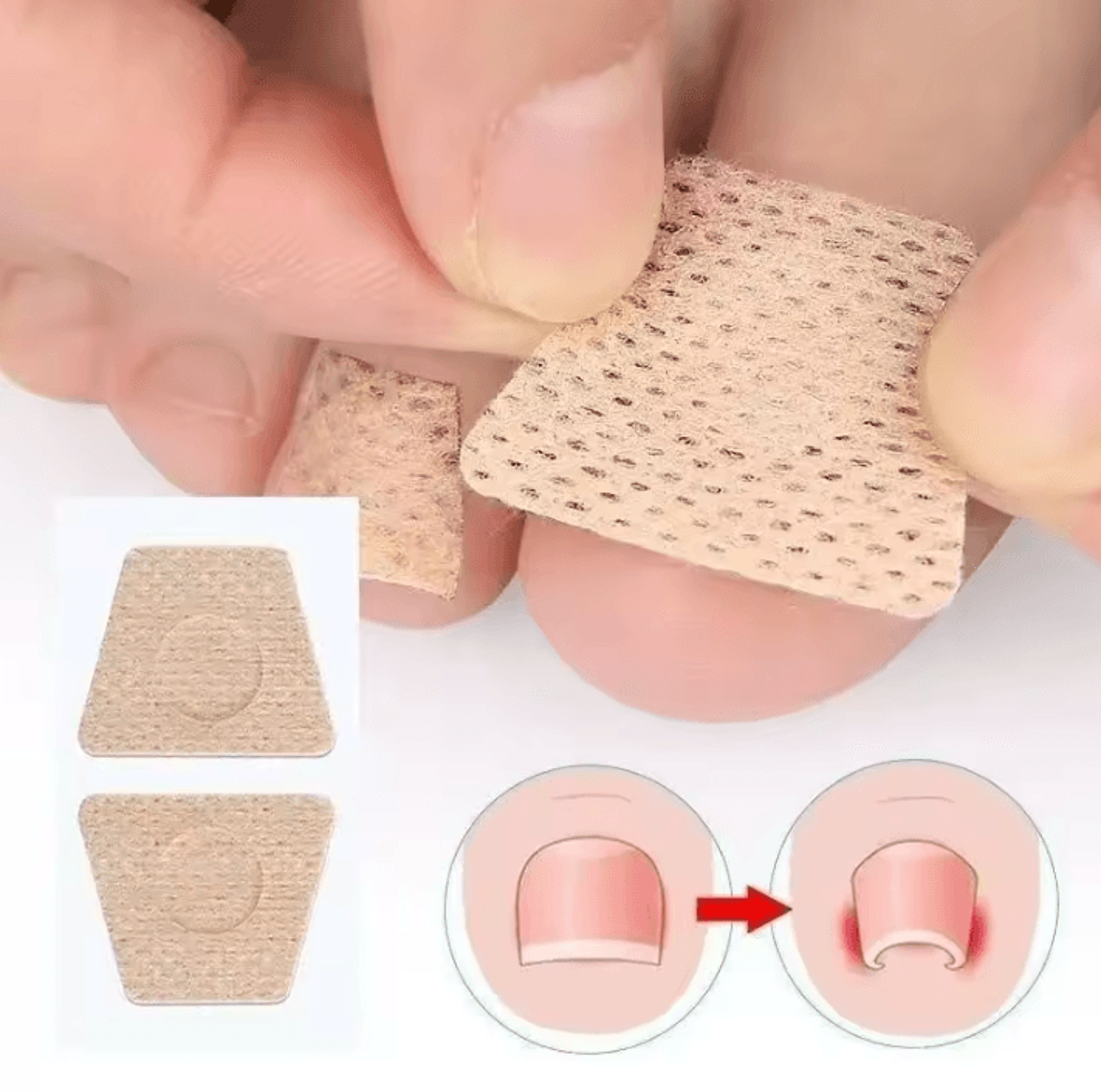 Toenail Care Repair Patches Adhesive Nail Stickers For Discolored Damaged And Ingrown Toenail Maint 2