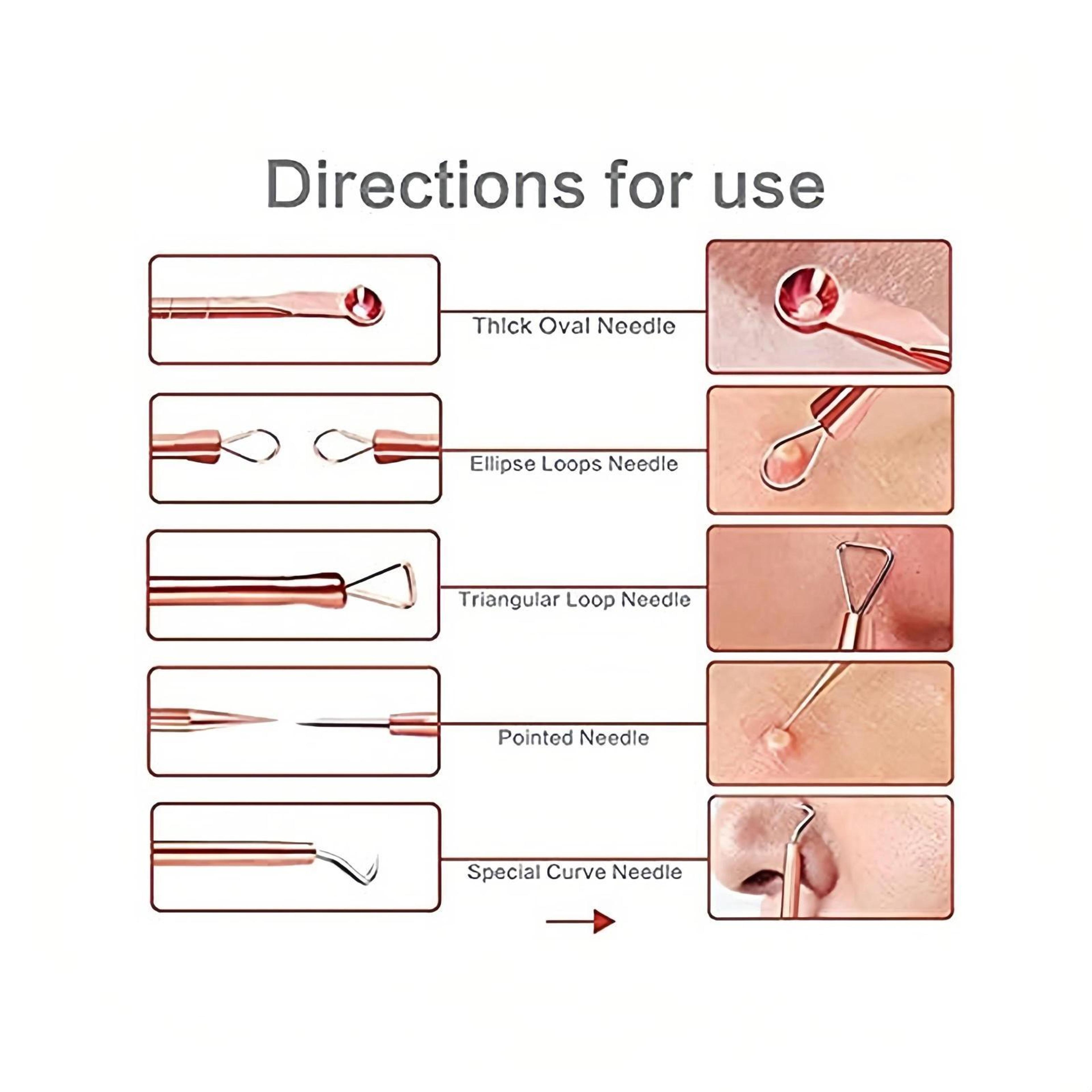 Precision Stainless Steel Blackhead Remover Tool Set For Acne Whiteheads  Milia Extraction 3