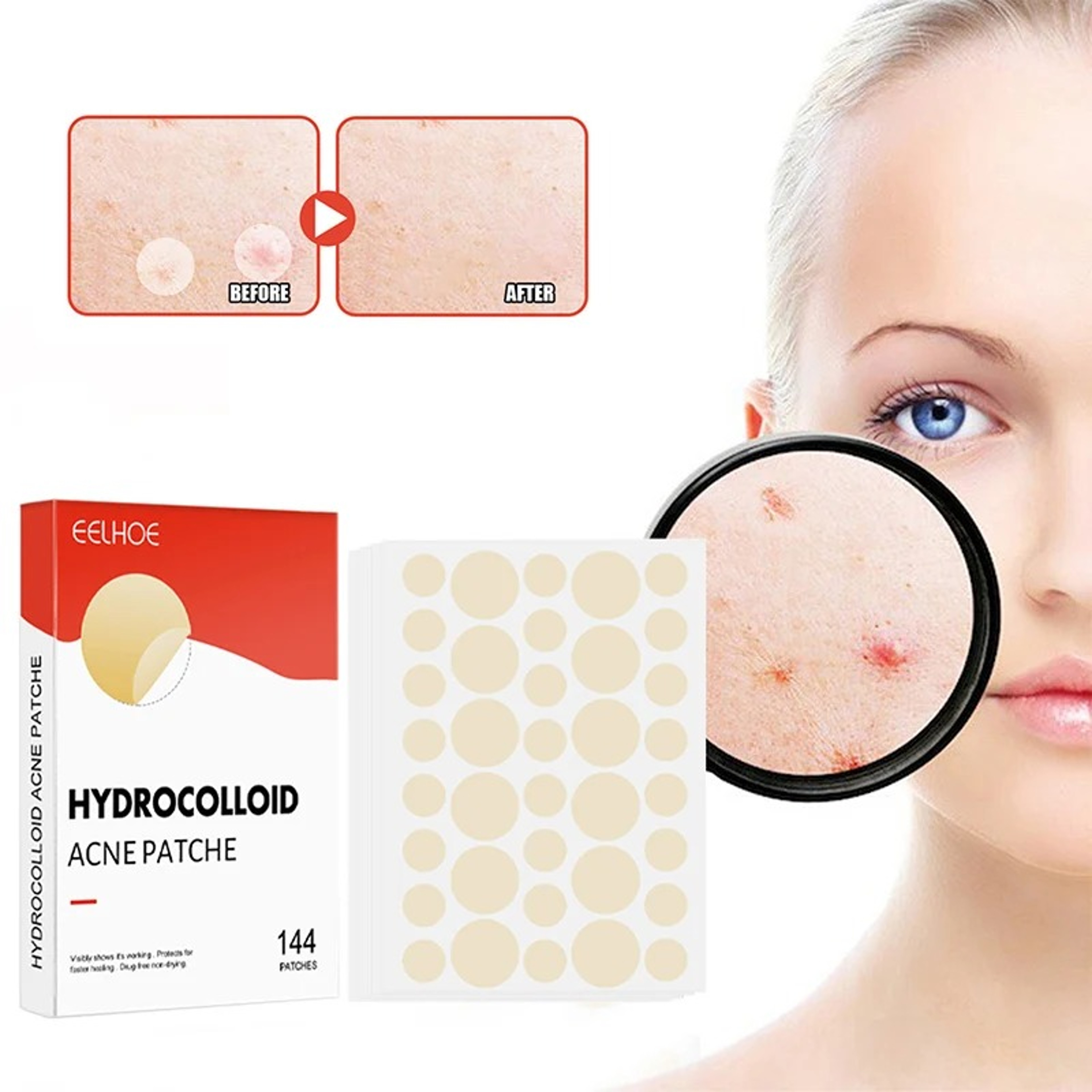 Professional Acne Patches, High-End Skin Care Pimple Stickers for Healing & Absorbing Spots – view 1