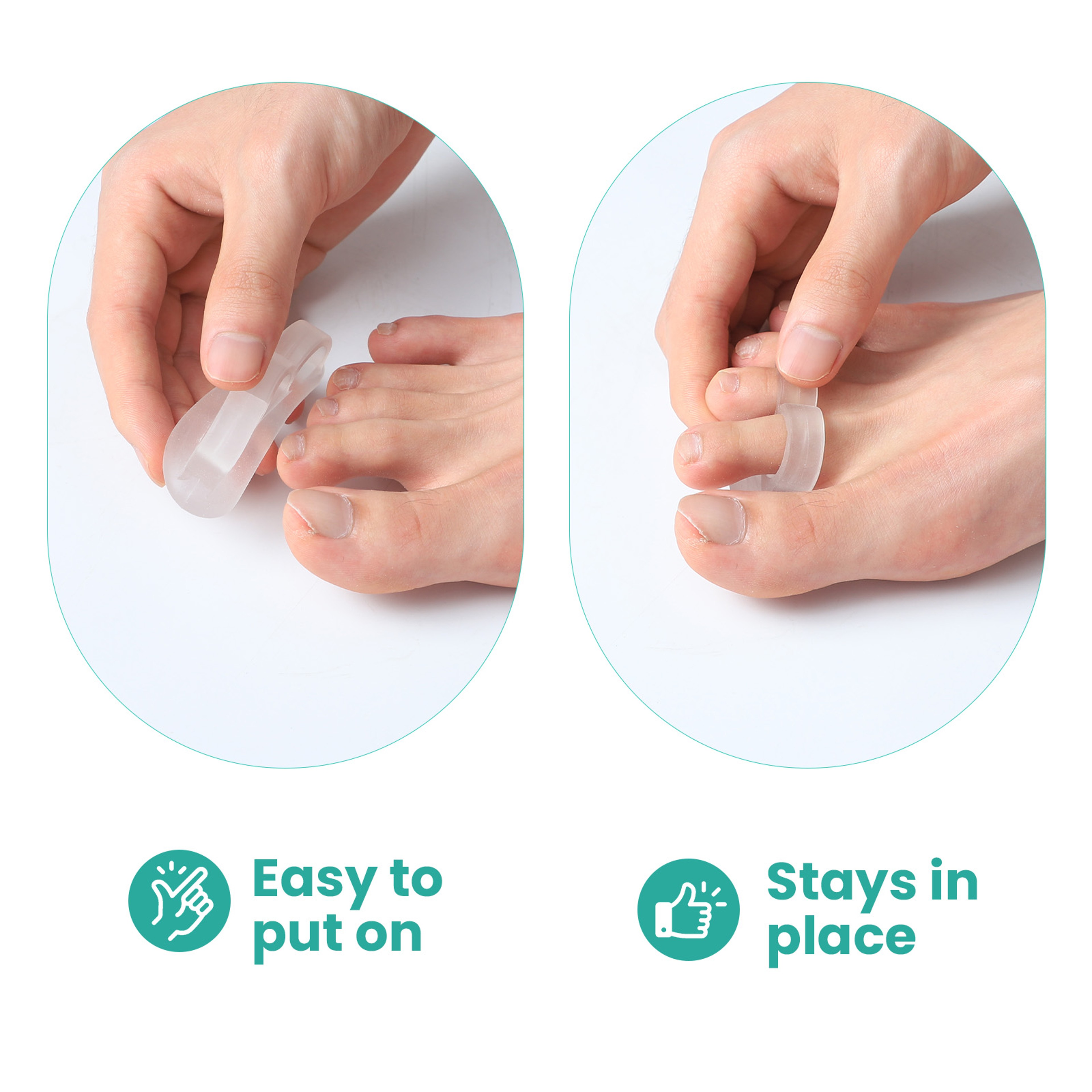 Sumifun Silicone White Toe Separator for Bunion, Hallux Valgus & Overlapping Toes, Foot Adjuster & Straightener Health – view 5