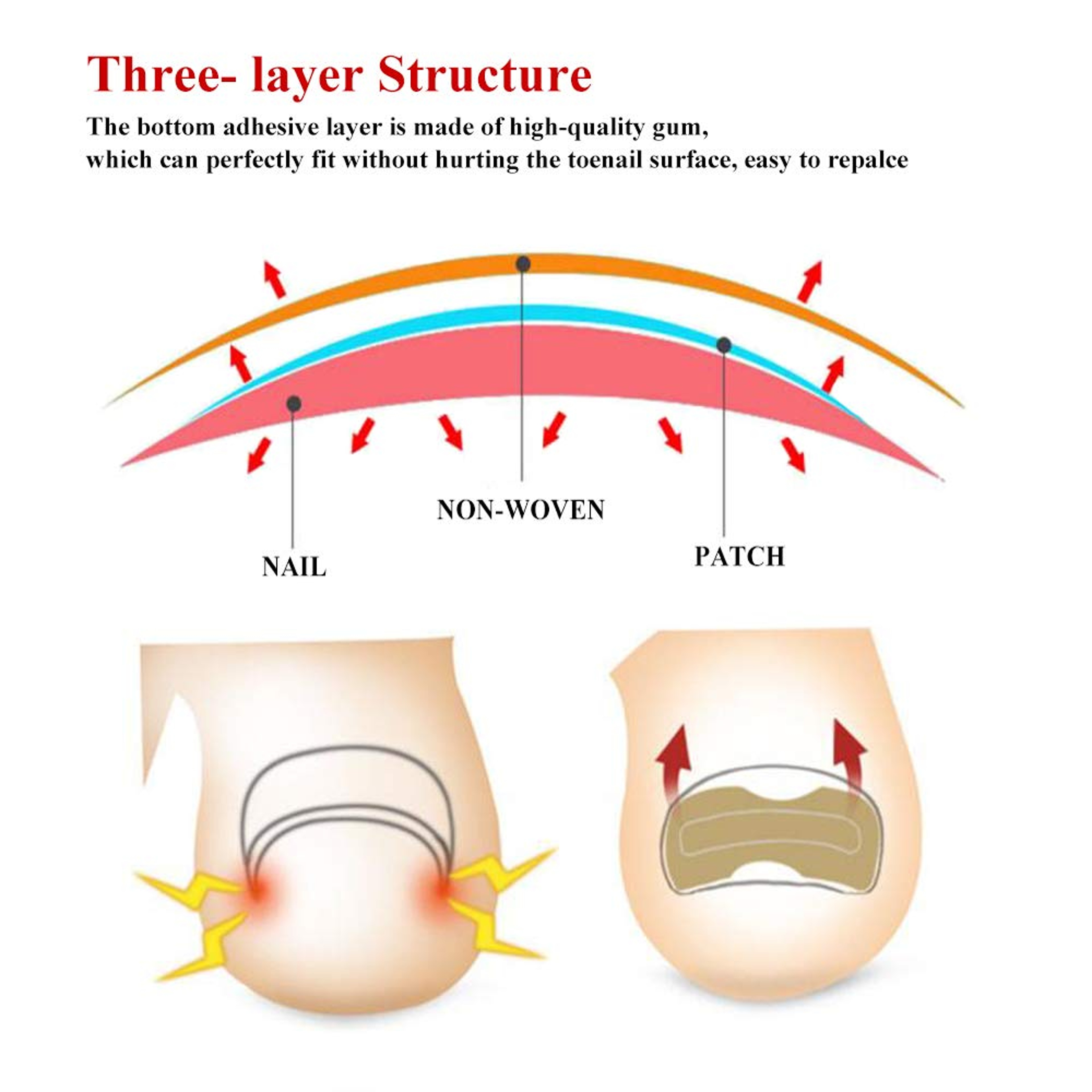 Highquality nail correction patches for home use