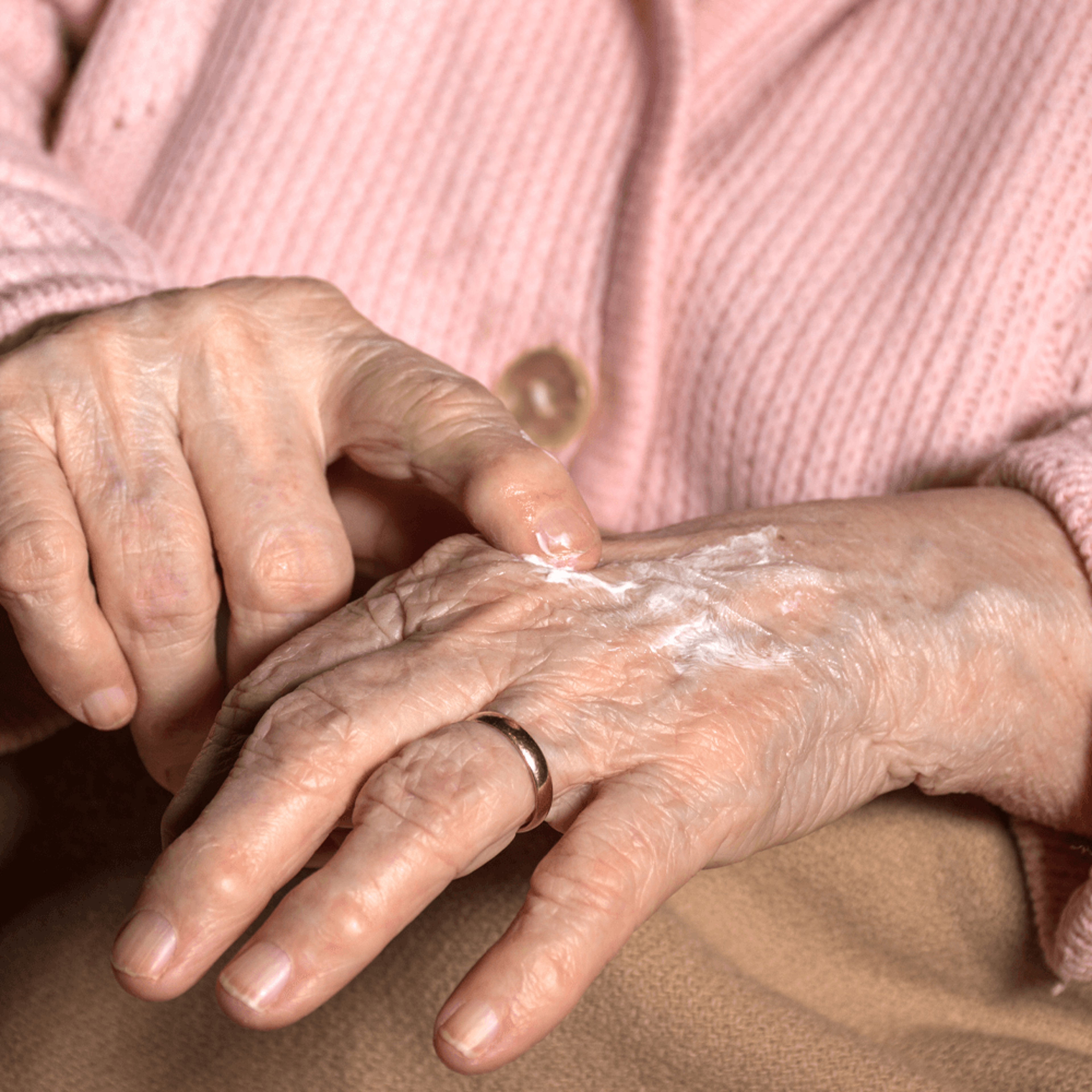 Vein Smoothing Varicose Veins Cream – view 4