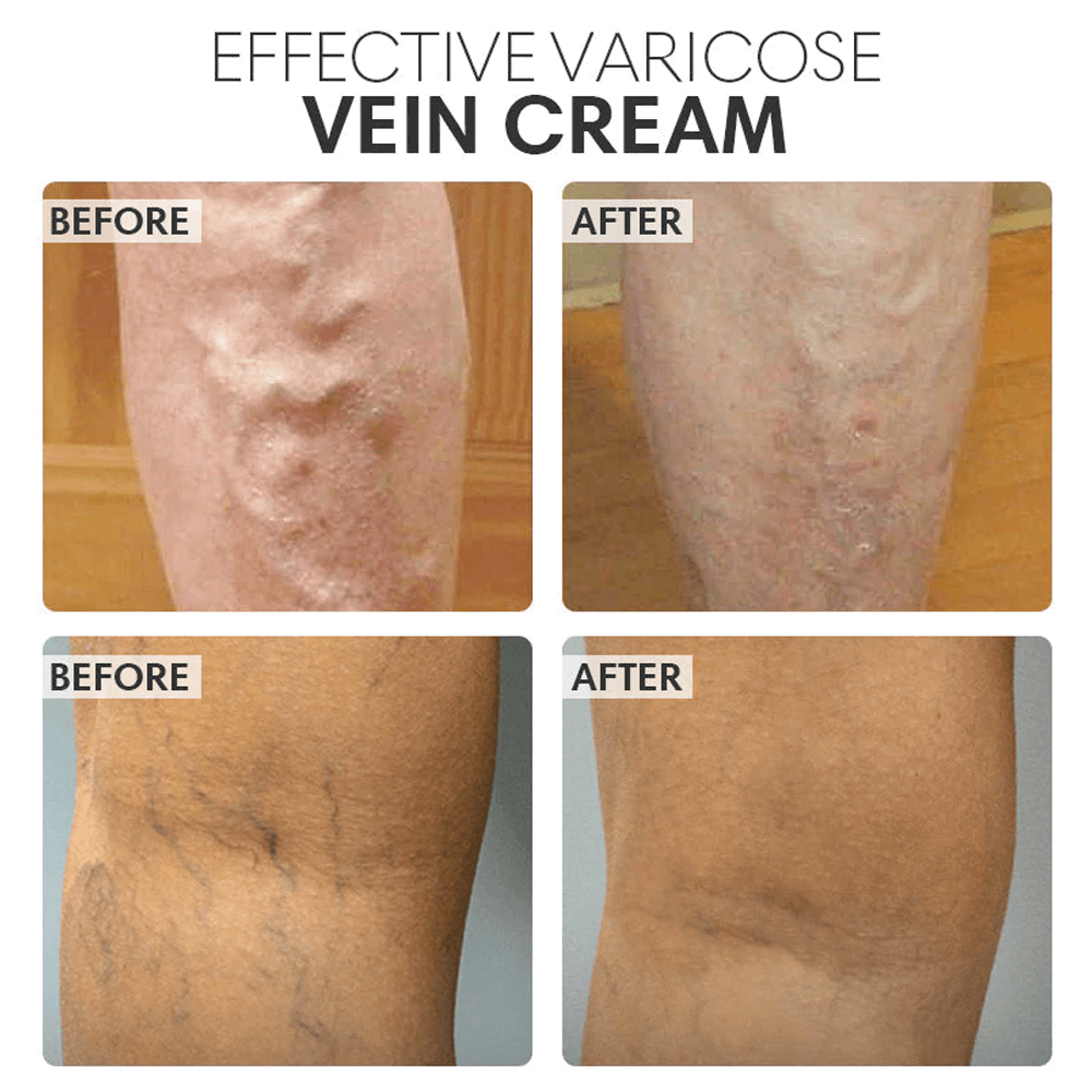 Vein Smoothing Varicose Veins Cream – view 5