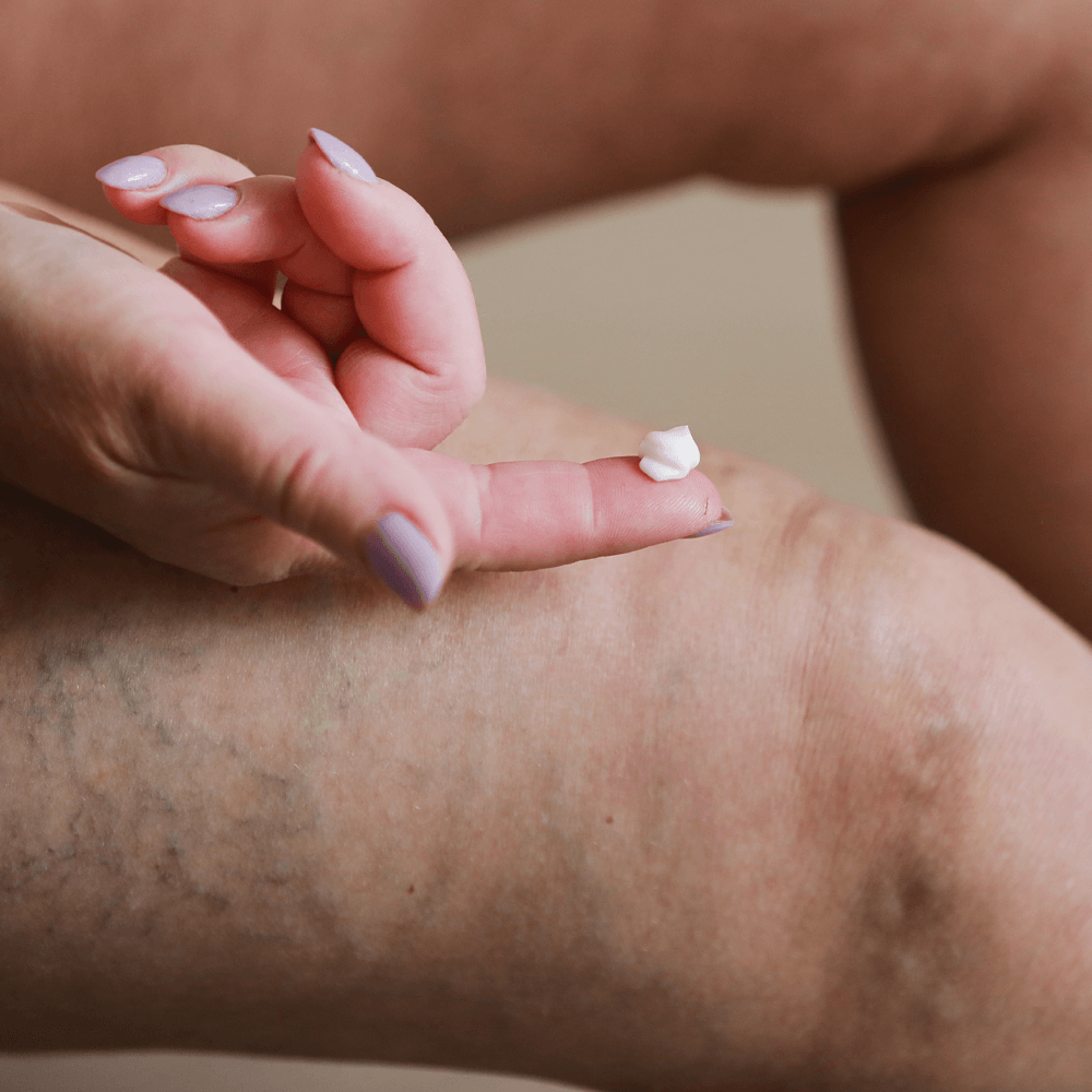 Vein Smoothing Varicose Veins Cream – view 1
