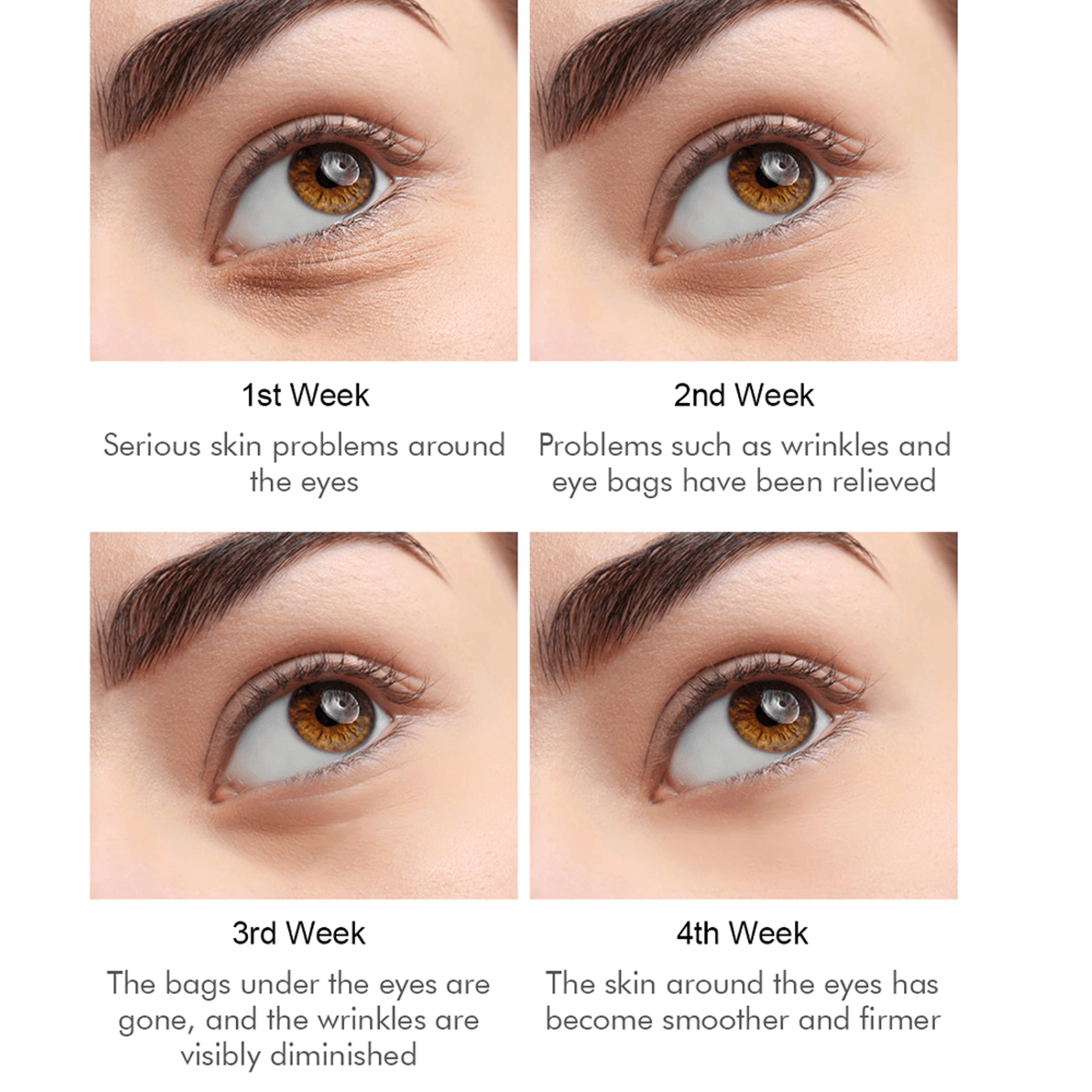 Anti-Wrinkles Magical Eye Cream – view 3