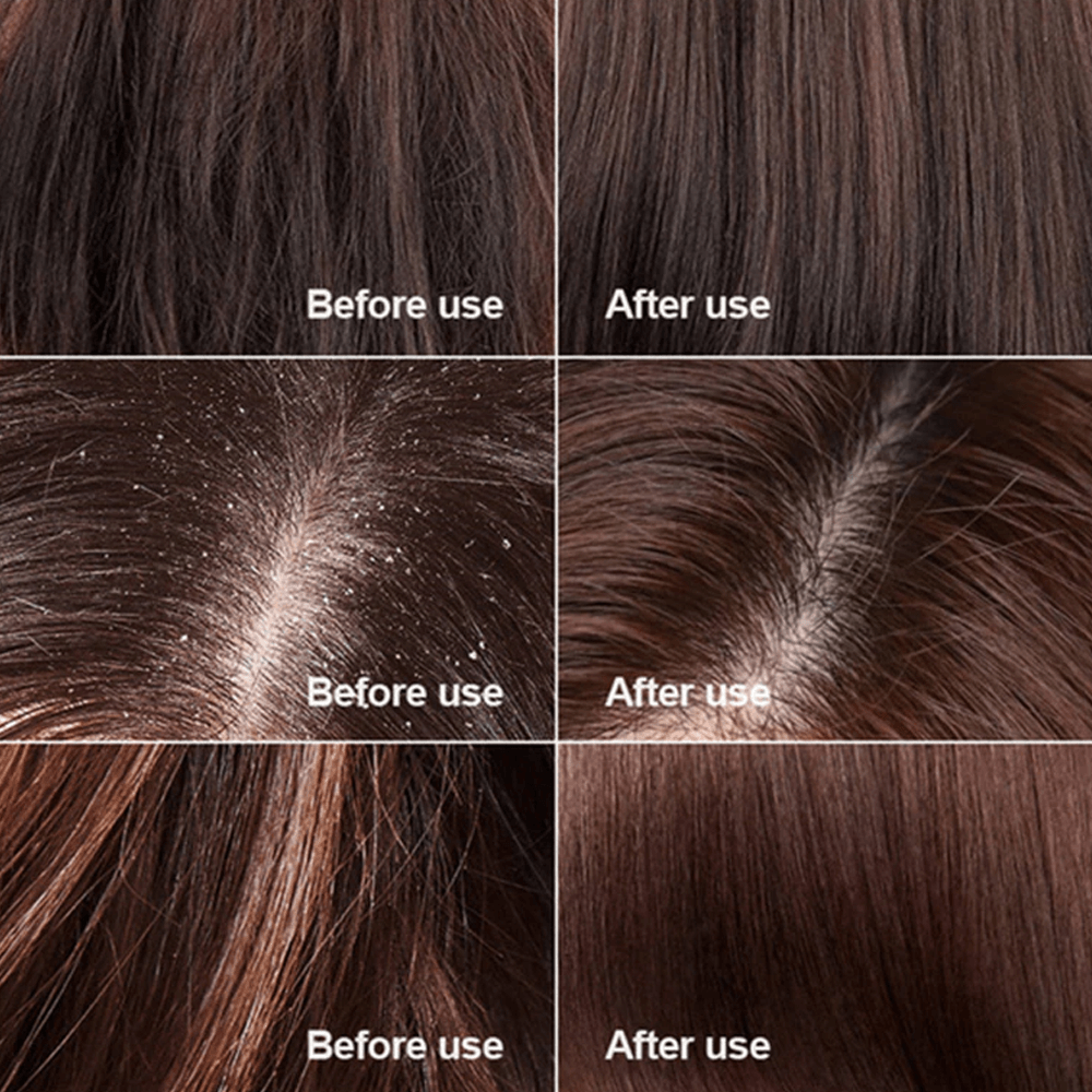 Instant Hair Regrowth Centella Scrub – view 3