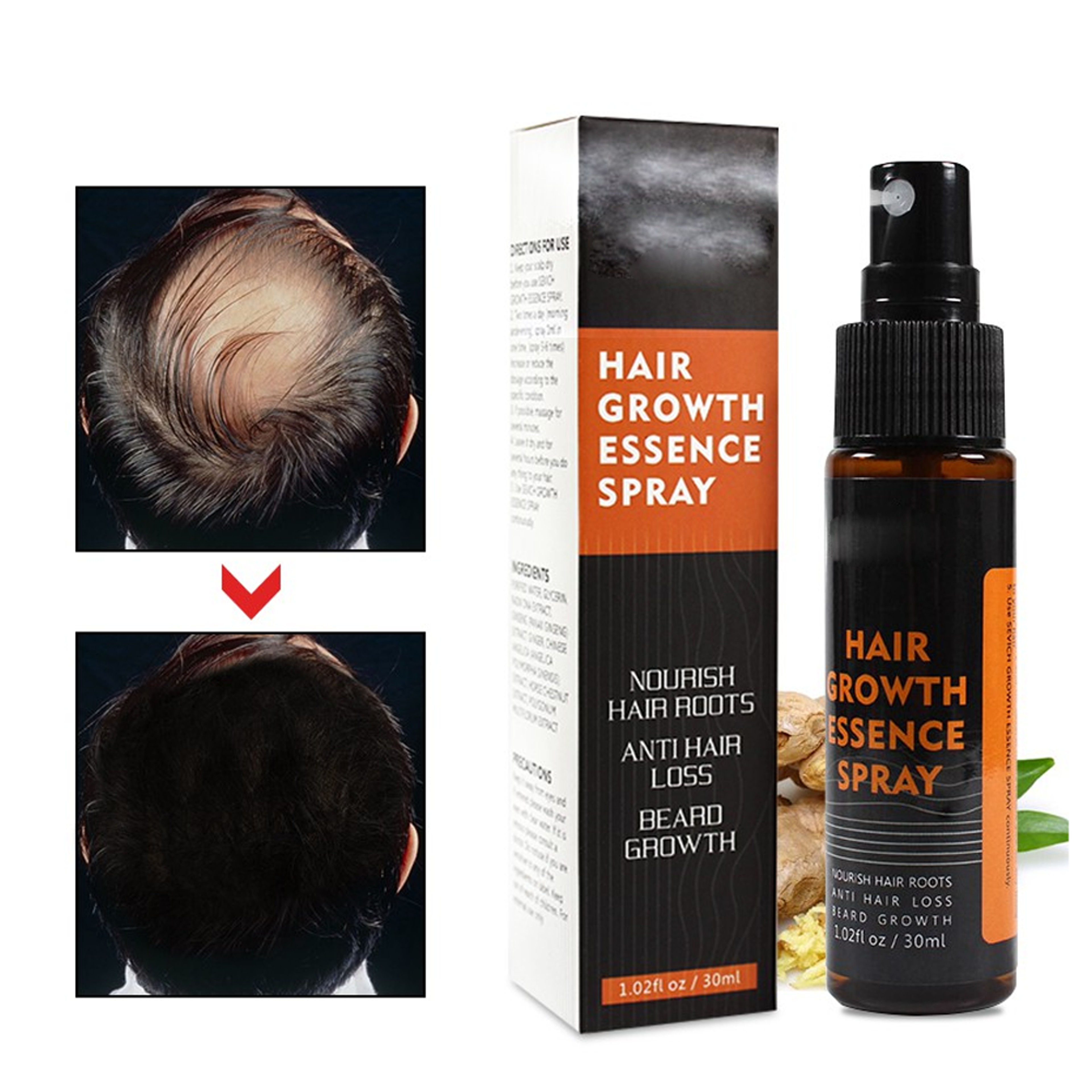 Hair Re-Growth Herbal Essence Spray – view 4