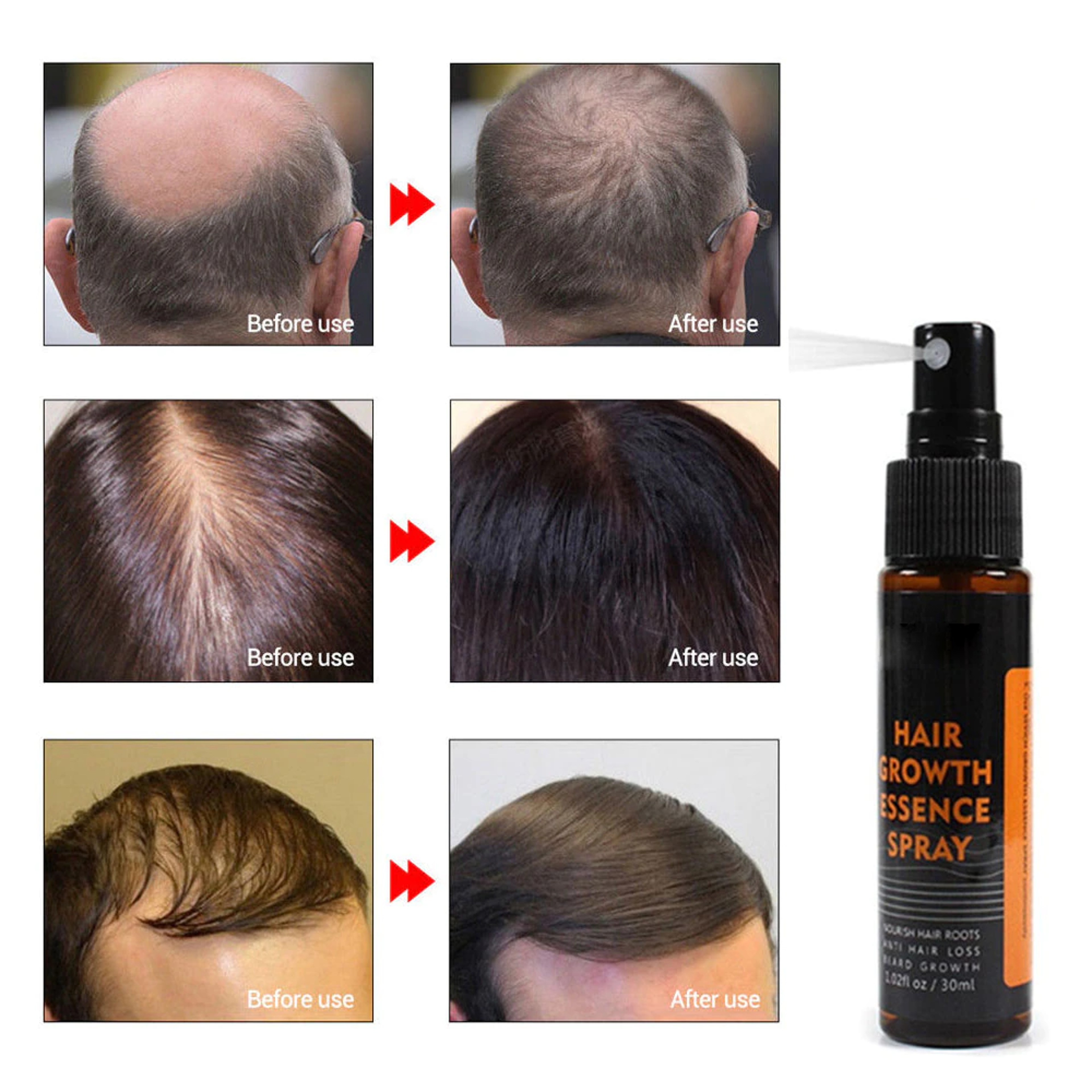Hair Re-Growth Herbal Essence Spray – view 5