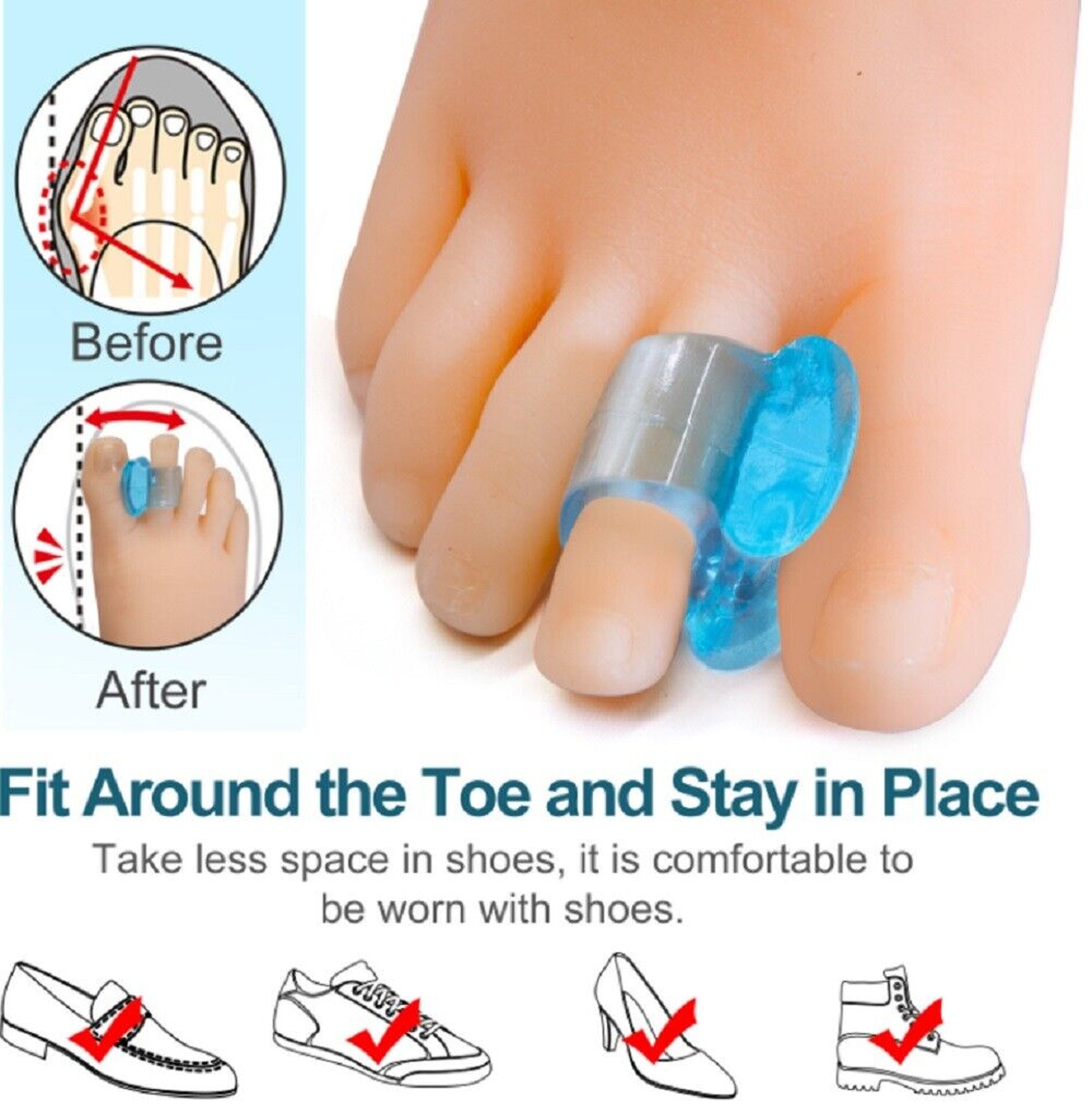 Silicone Gel Bunion Corrector Straightener Separator Pain Relief – view 1