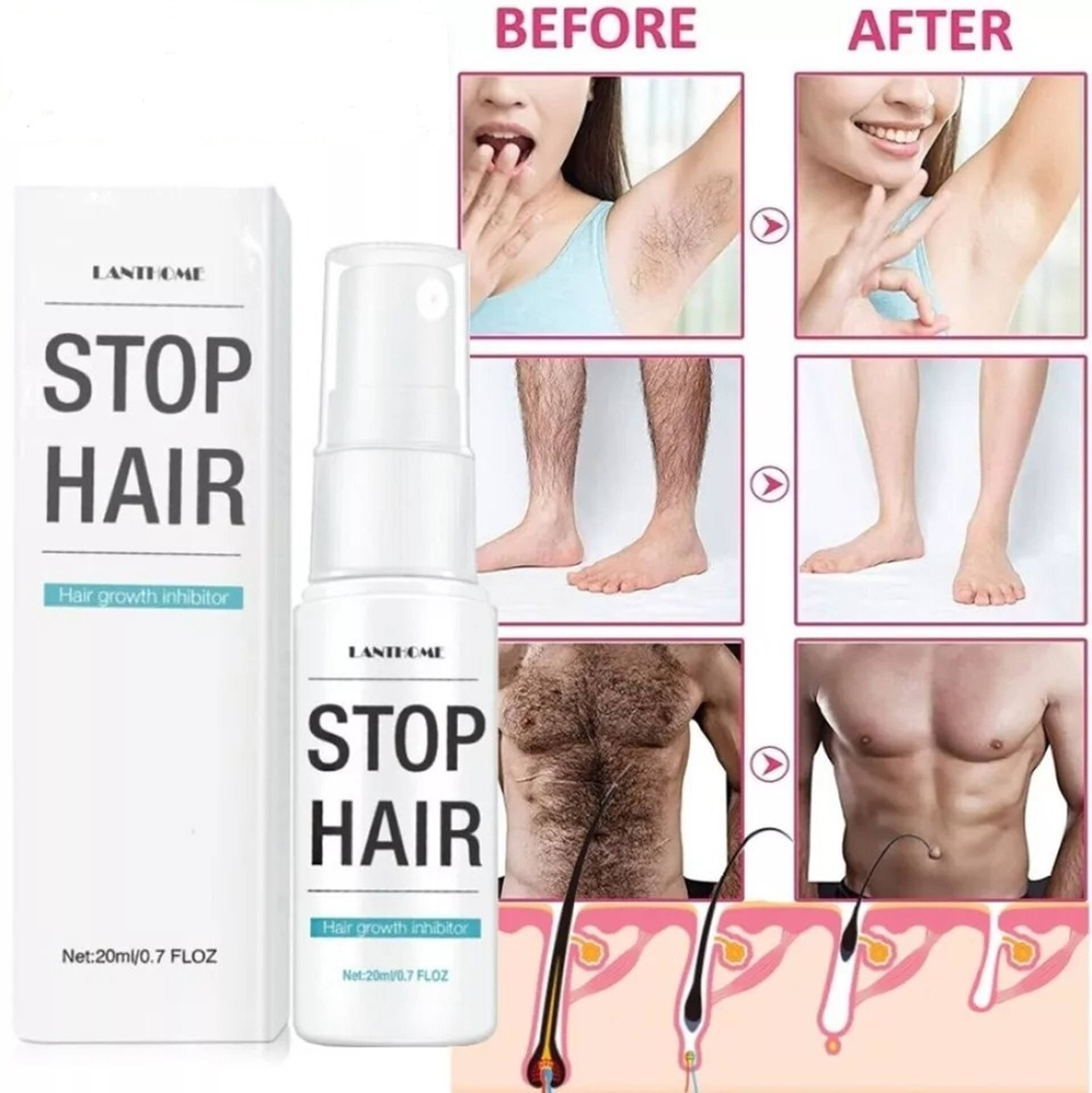 Natural Permanent Hair RemovalSpray Painless Stop Hair Growth Inhibitor Remover
