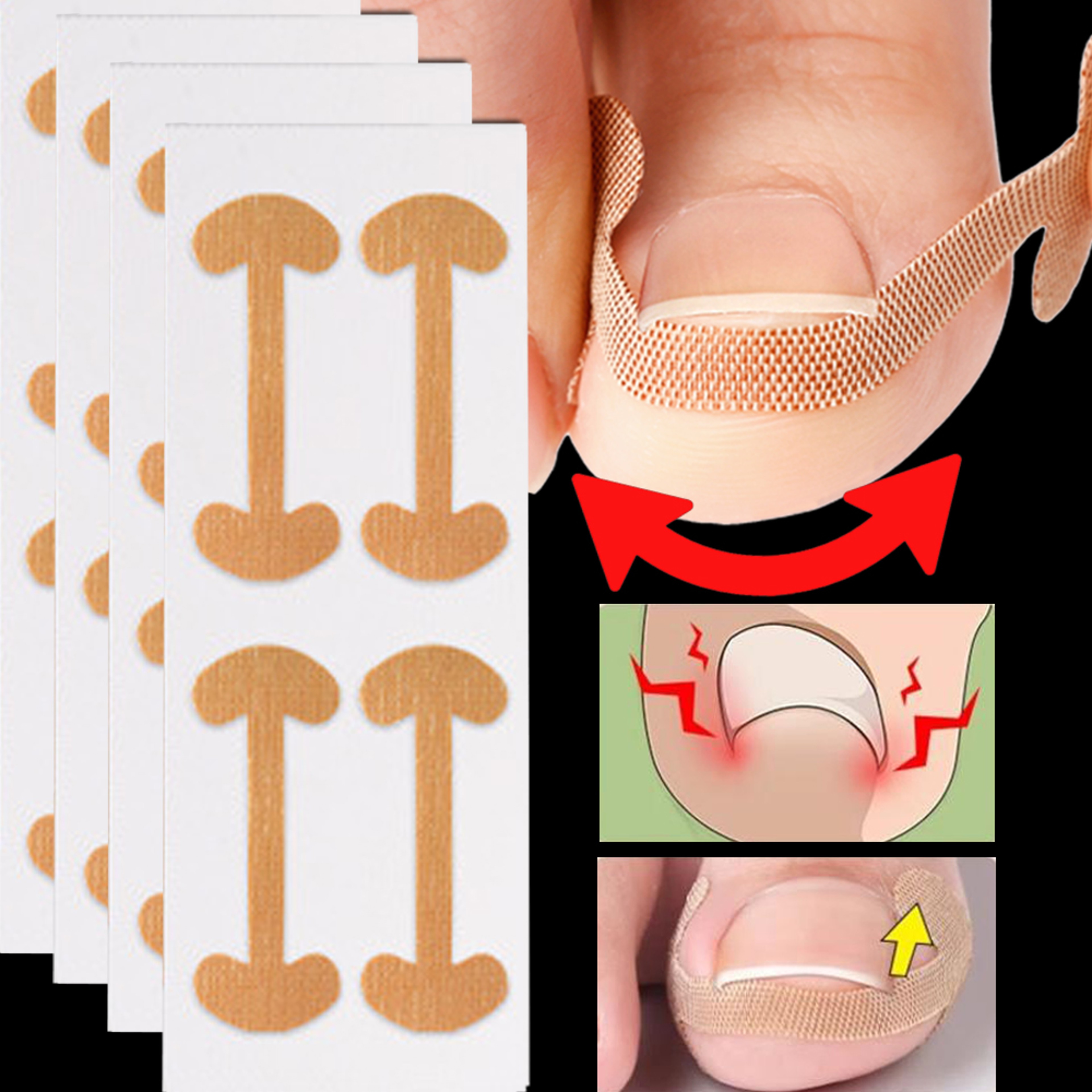 Ingrown Toenail Correction Strips Waterproof Nail Care Stickers For Comfortable Toe Support 2